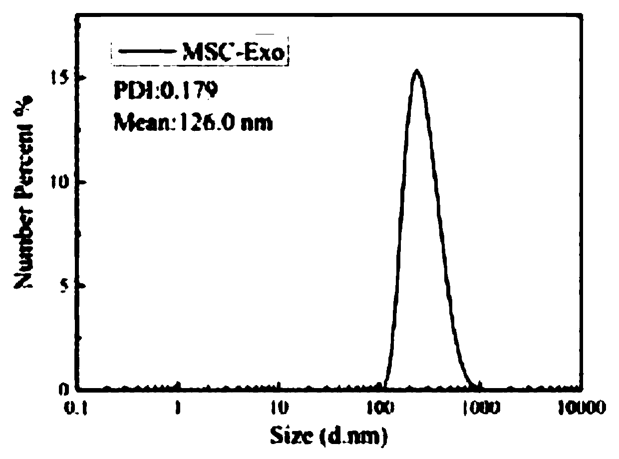 Preparation method and application of oral microspheres loaded with MSCs-derived exosomes