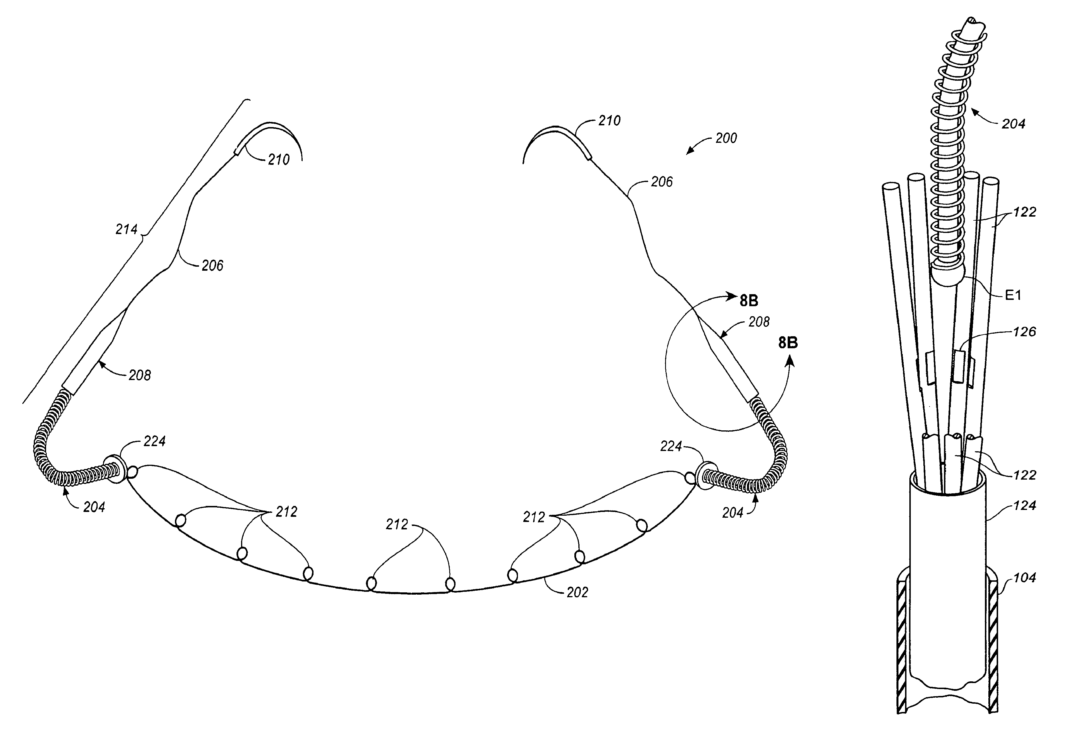 Annuloplasty apparatus and methods