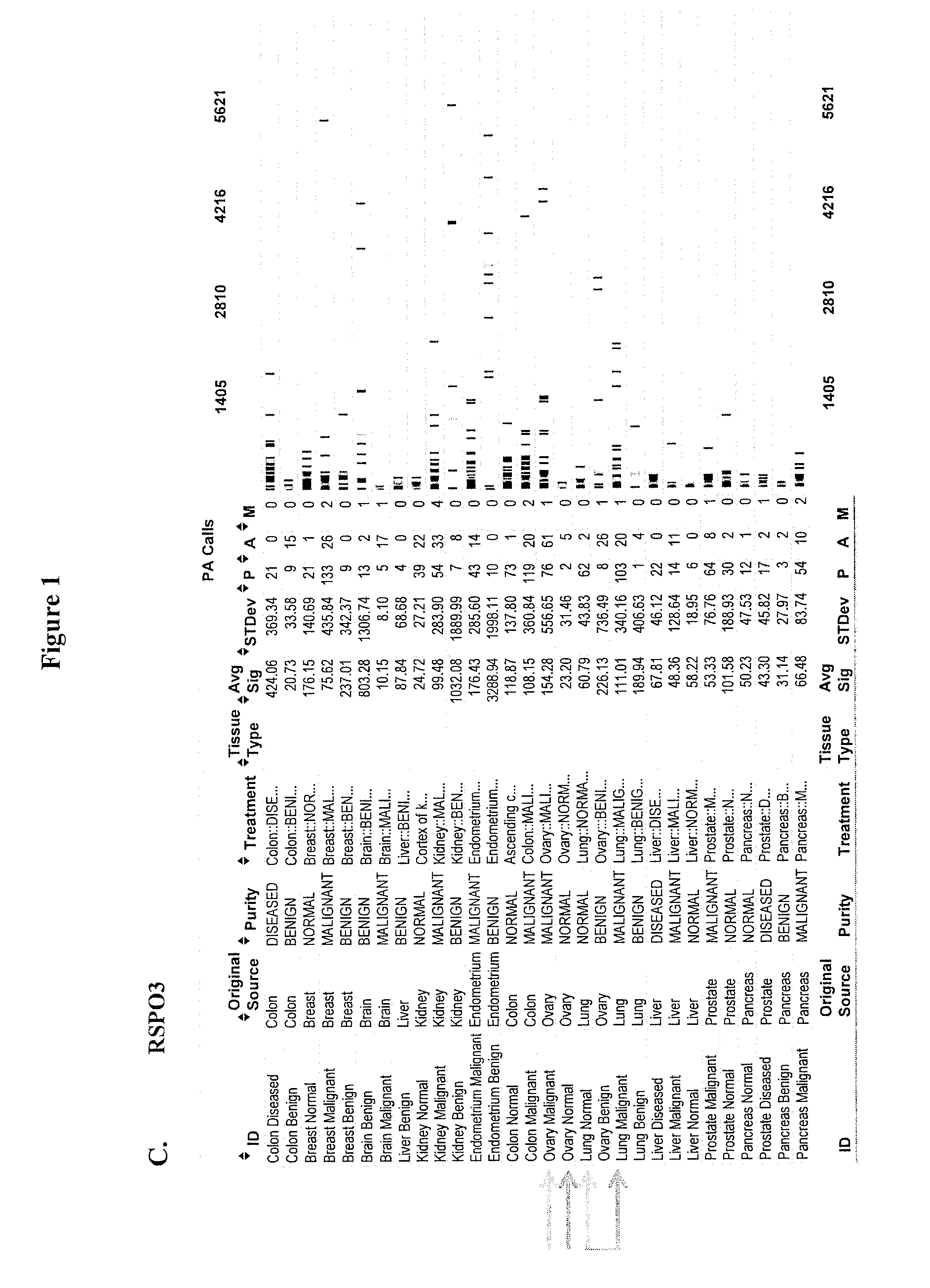 Rspo binding agents and uses thereof