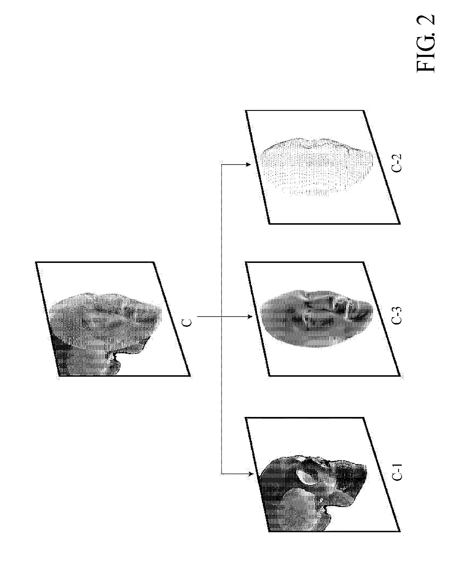 Three-dimensional digital magnifier operation supporting system