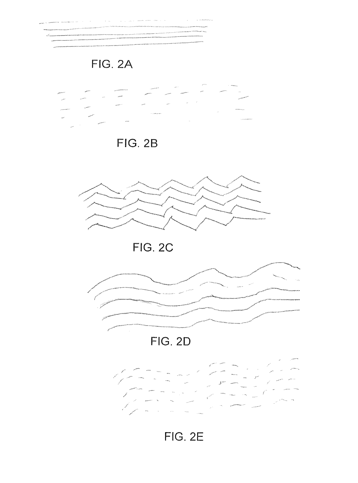 Device and method for treating neuropathy
