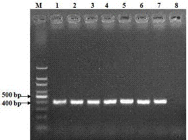 PCR (Polymerase Chain Reaction) amplification primer for quickly detecting mycoplasma ovipneumoniae, and application thereof