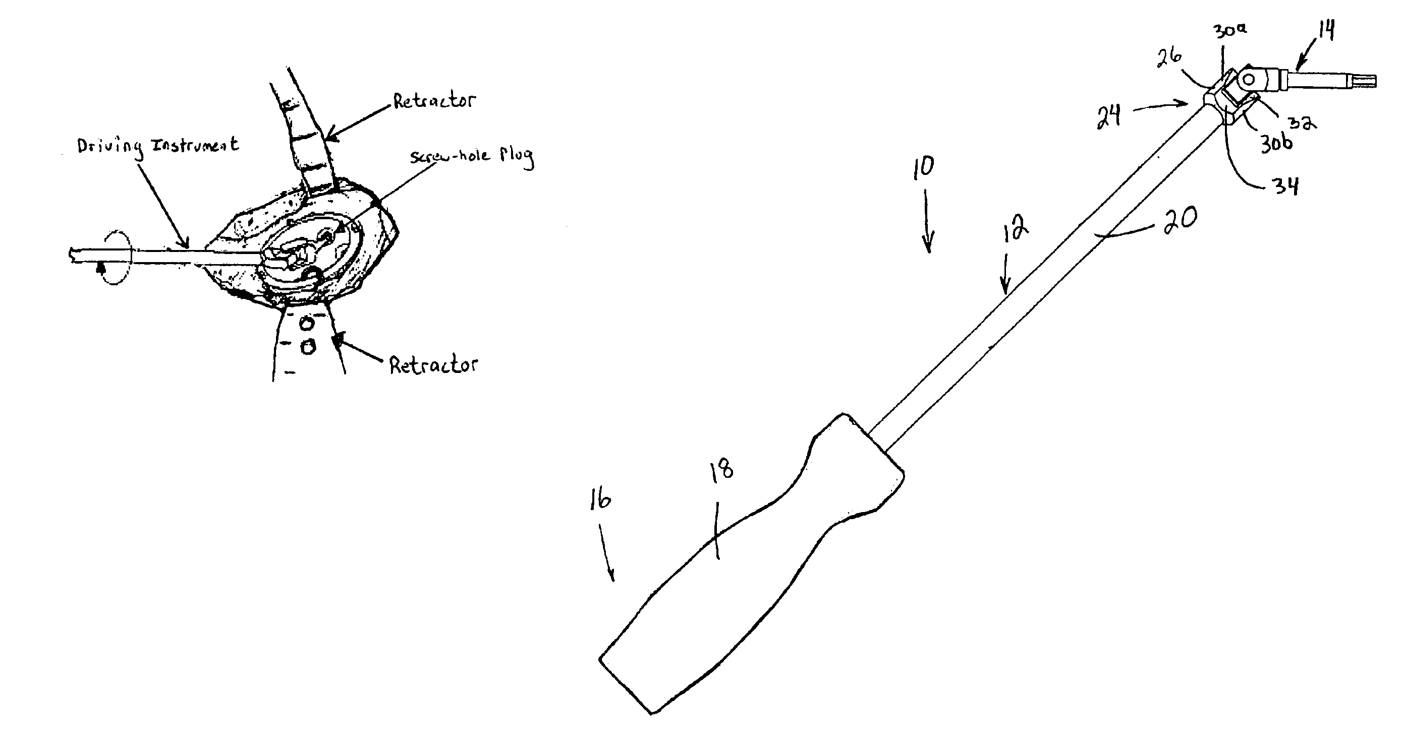 Driving instrument with variably angled joint and extended tip and method of use for minimally invasive hip surgery