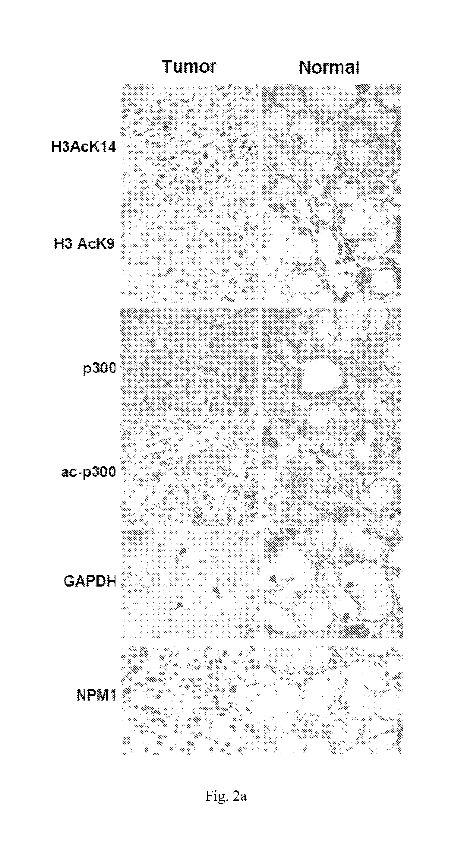 Inhibition of histone acetyltransferases by ctk7a and methods thereof