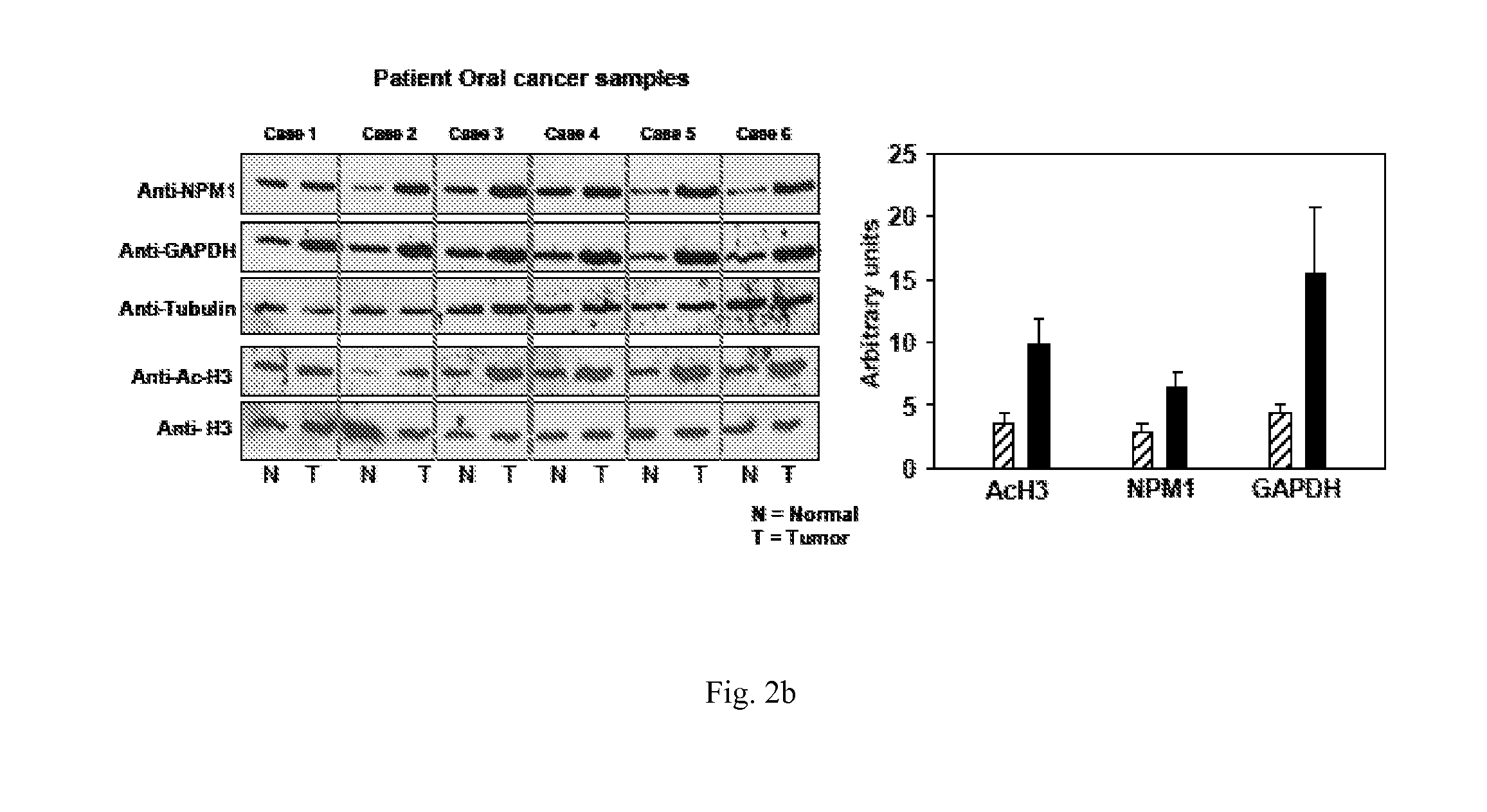 Inhibition of histone acetyltransferases by ctk7a and methods thereof