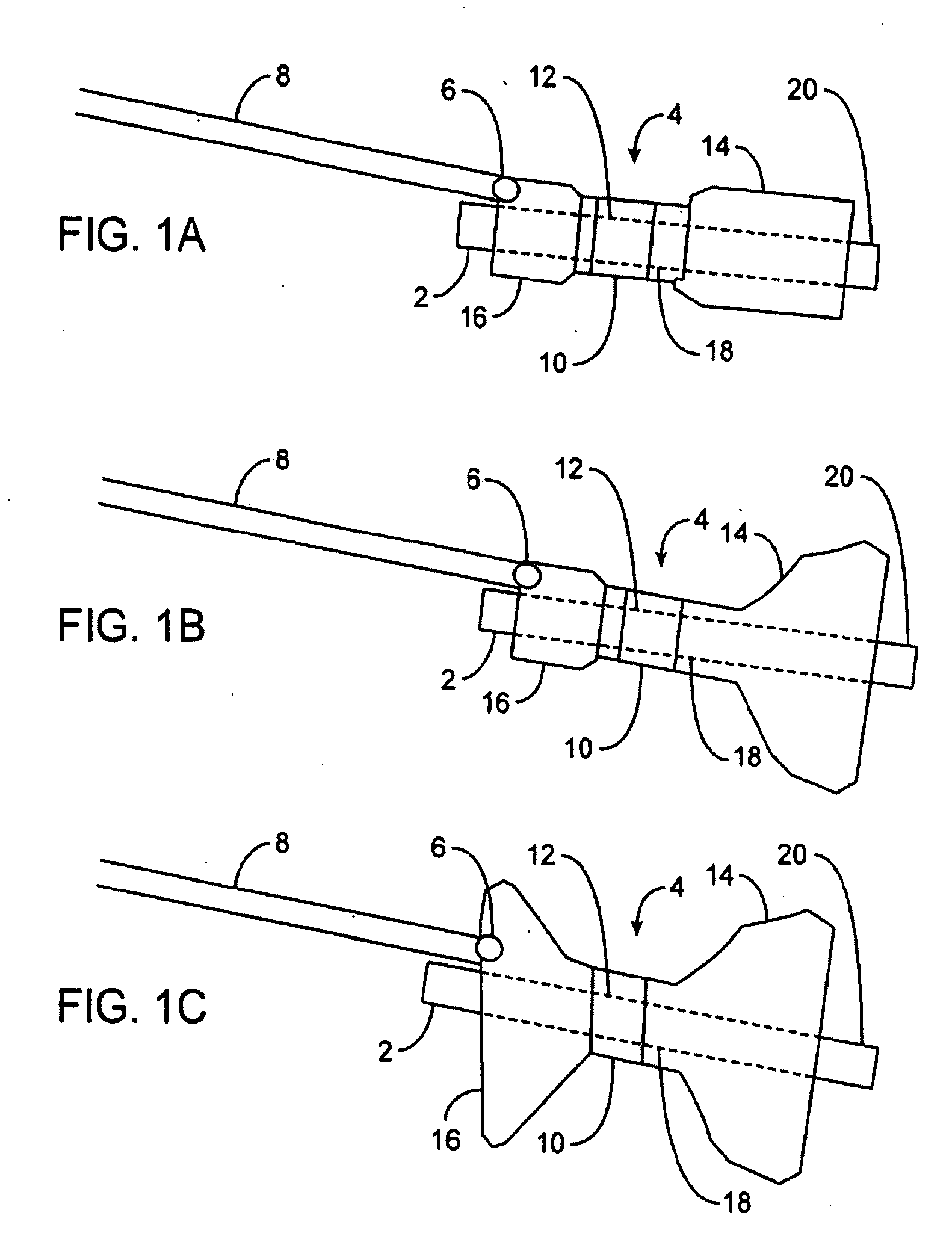 Gastric retaining devices and methods