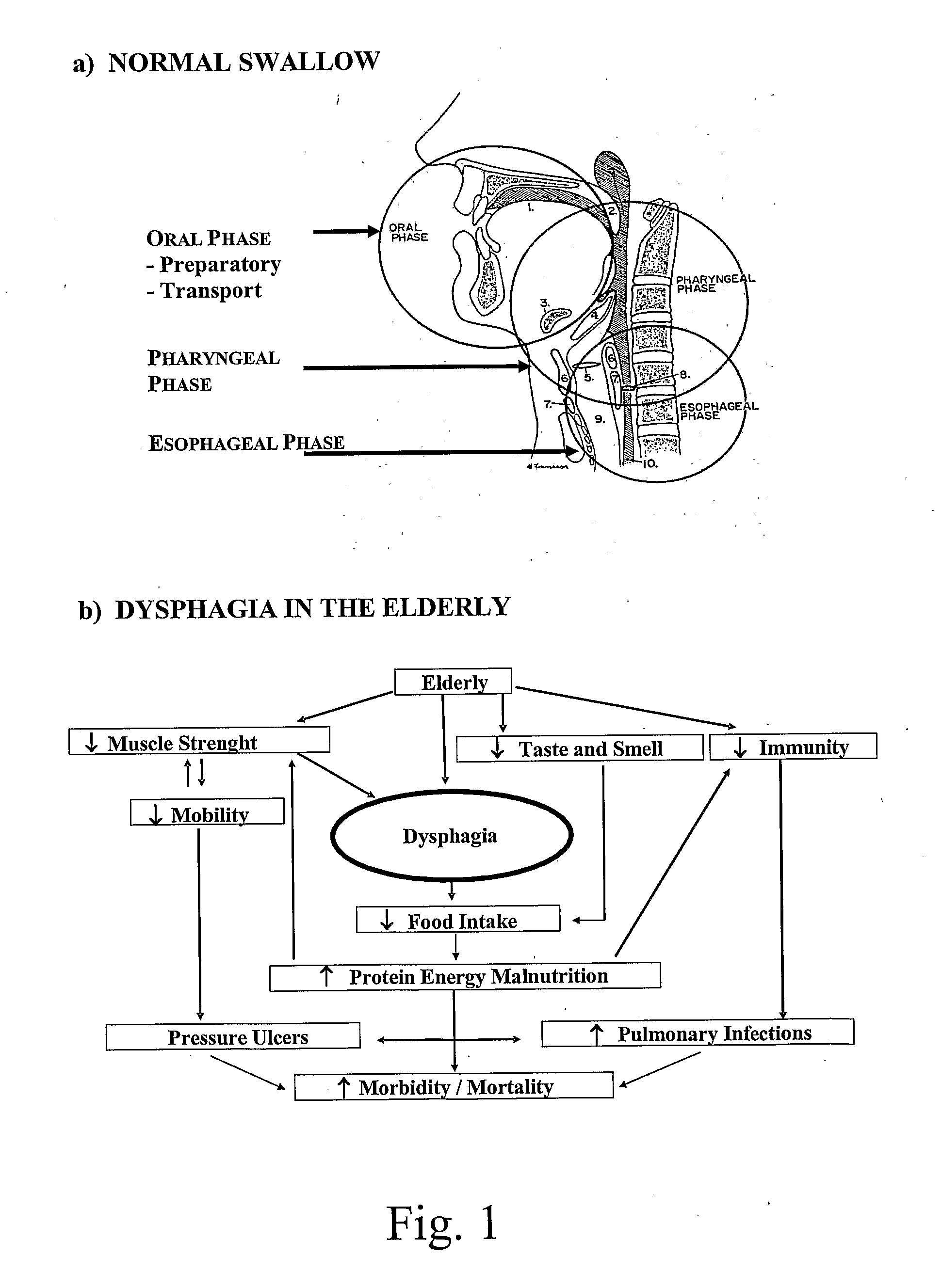 Index and Method of use of Adapted Food Compositions for Dysphagic Persons