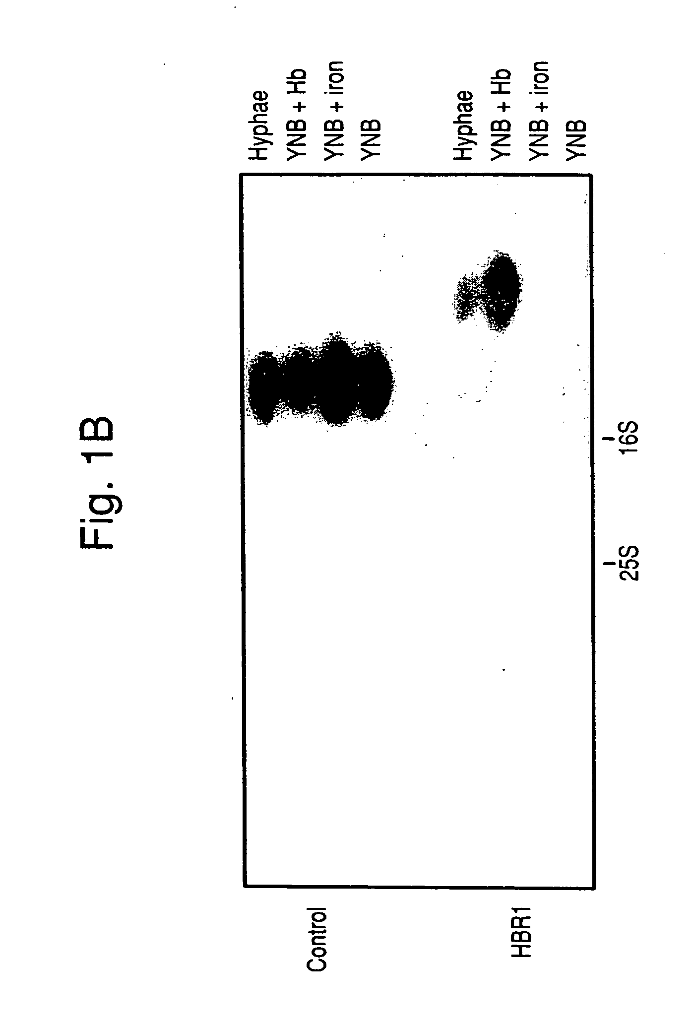 Nucleic acid and amino acid sequences of hemoglobin-response genes in Candida albicans and the use of reagents derived from these sequences in the diagnosis of disseminated Candida albicans infection