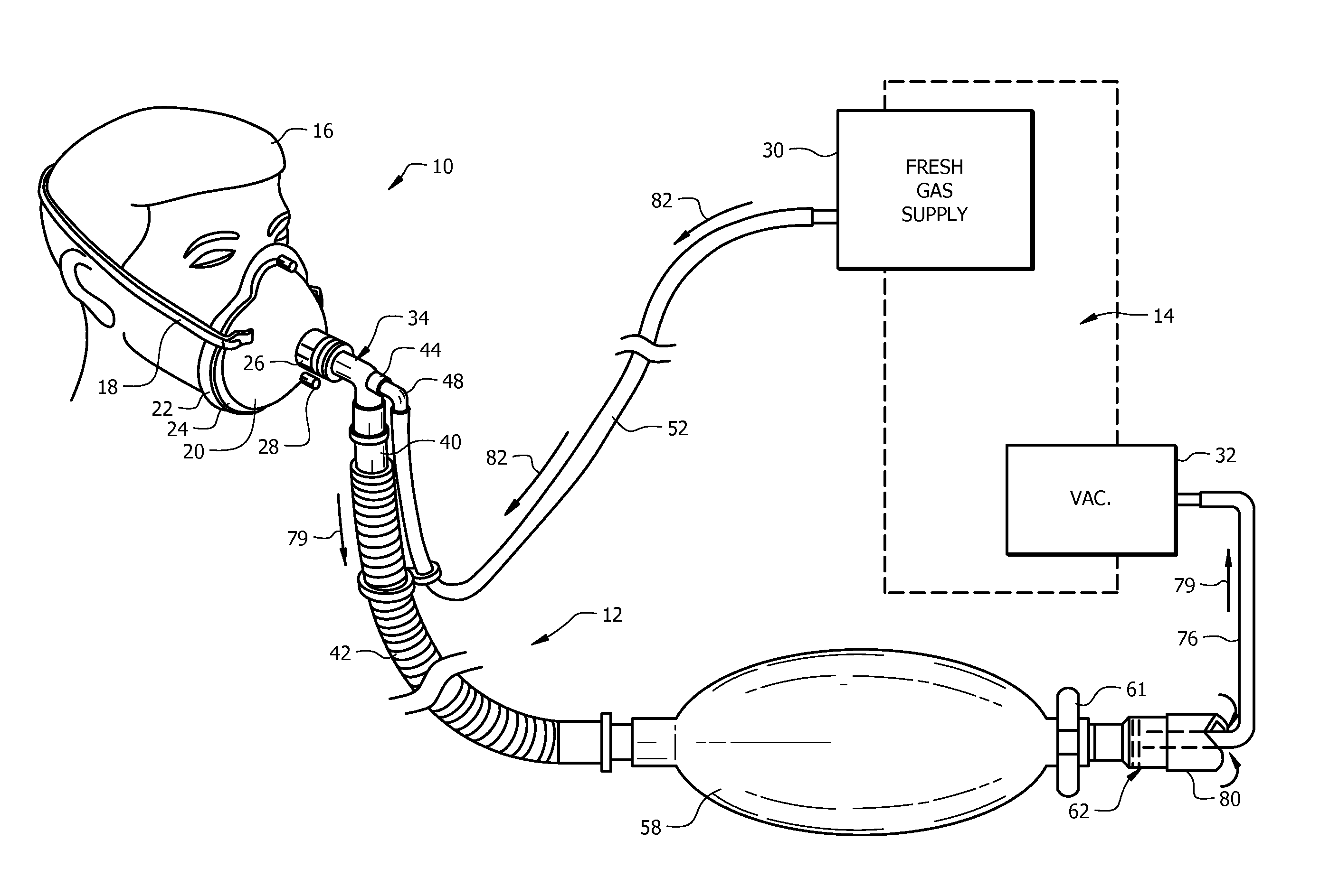 Respiratory face mask and breathing circuit assembly