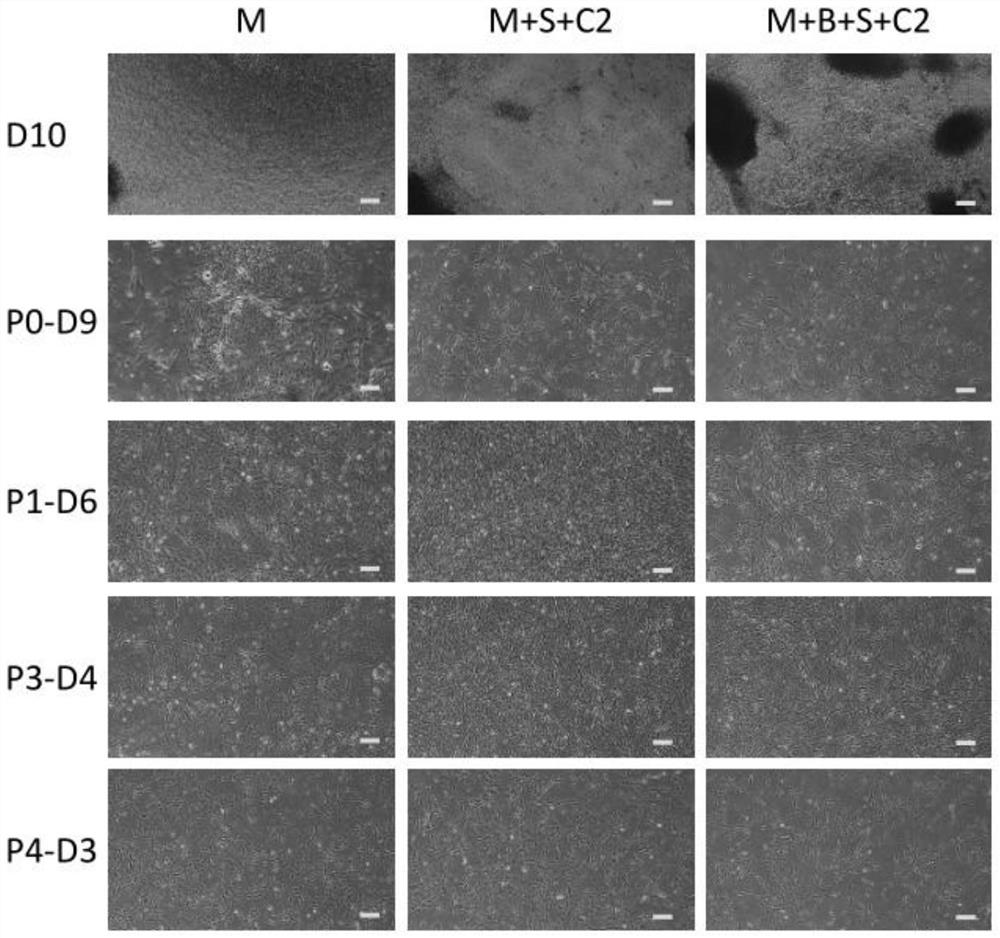 A preparation method and kit for clinical-grade human induced pluripotent stem cell-derived mesenchymal stem cells