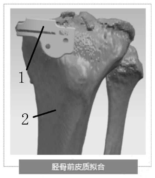 Design method of guide plate for unicompartmental knee arthroplasty and related equipment