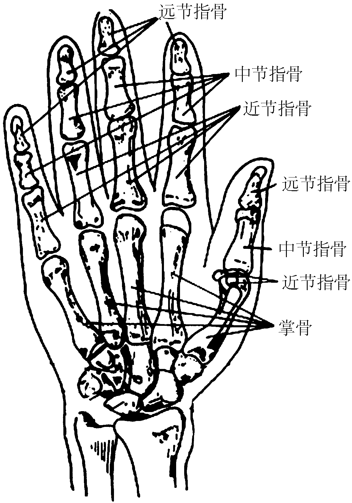 Software driver for assisting four-finger stretching of human hand