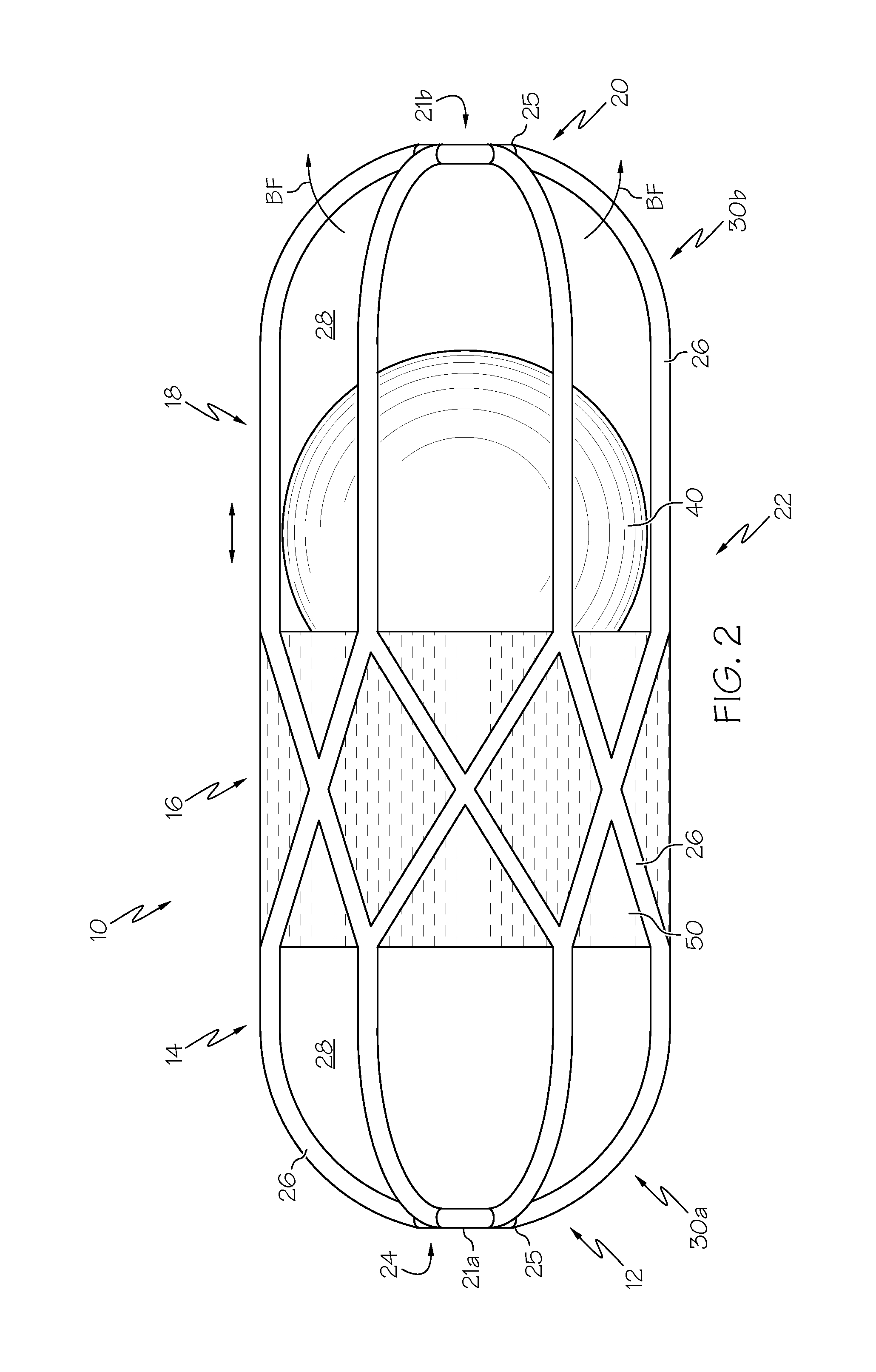 Collapsible caged-ball prosthetic valve for transcatheter delivery and method of use