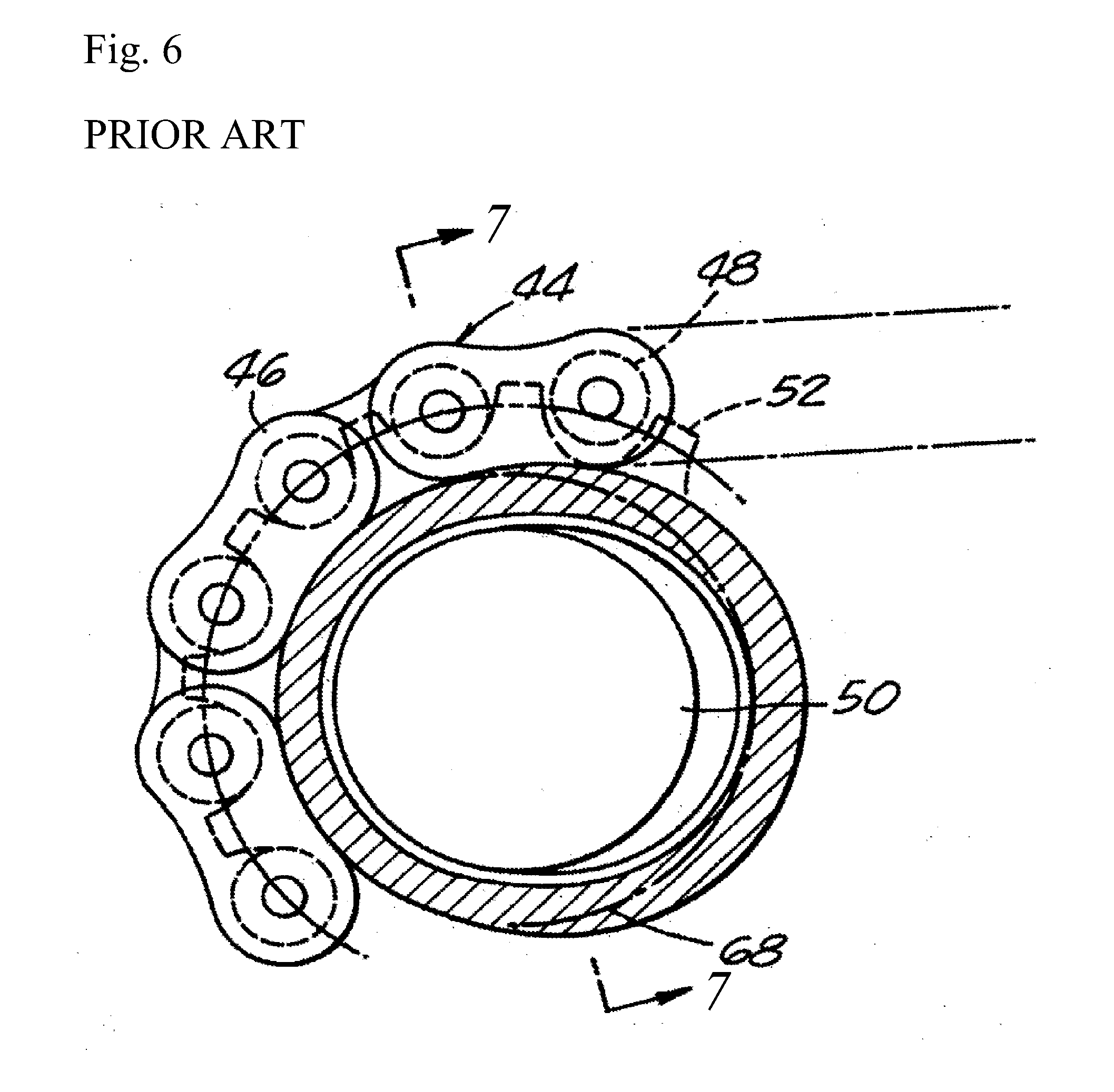 Chain noise reduction device