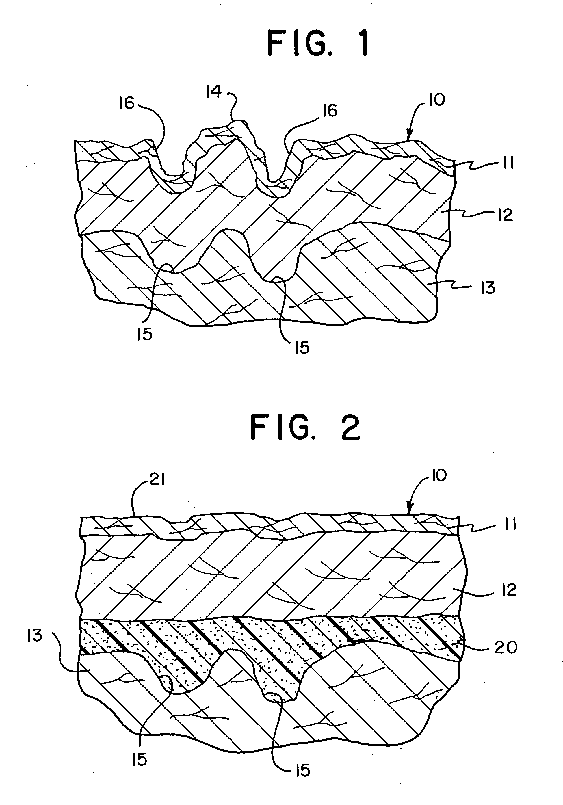 Soft tissue substitute and method of soft tissue reformation