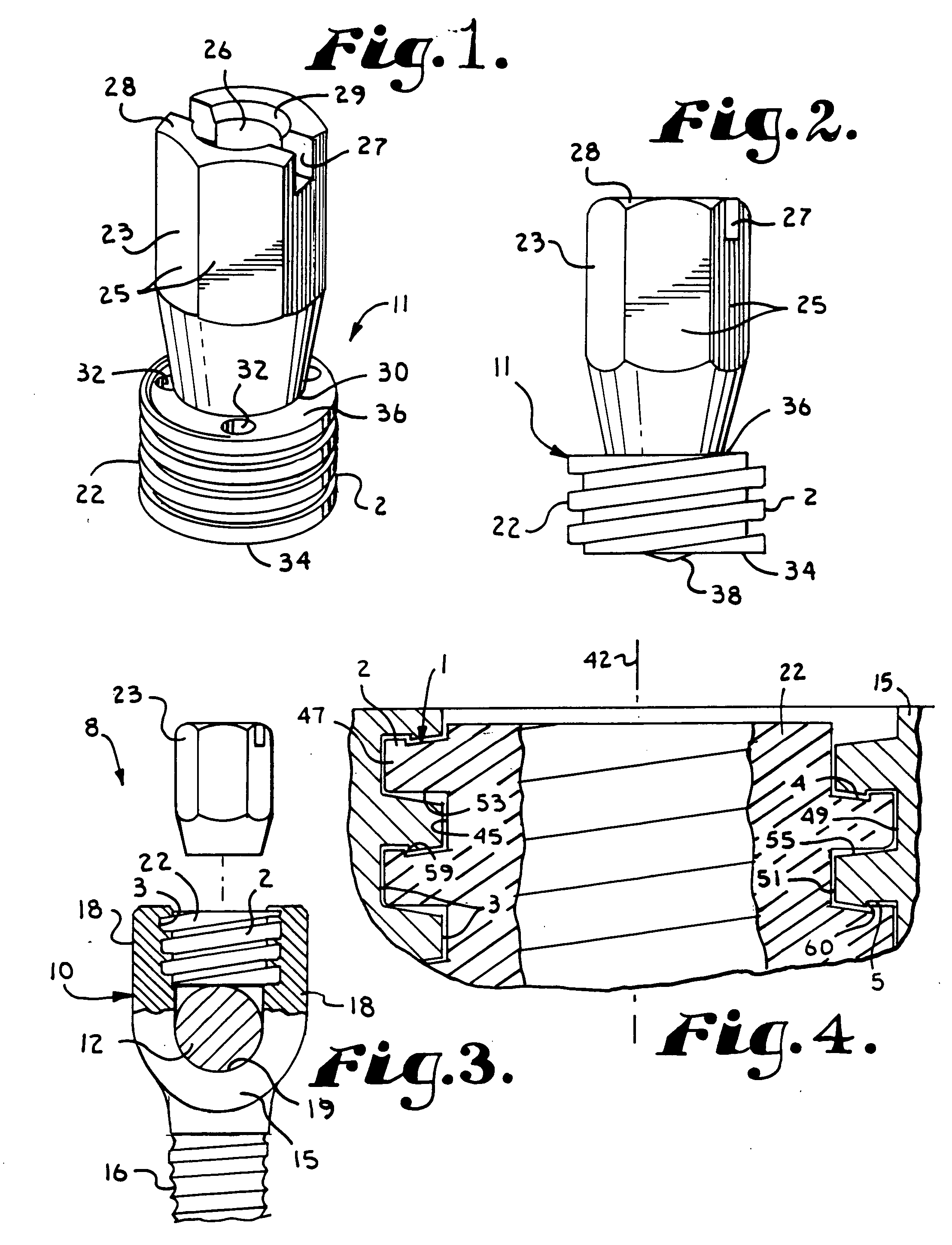 Helical interlocking mating guide and advancement structure