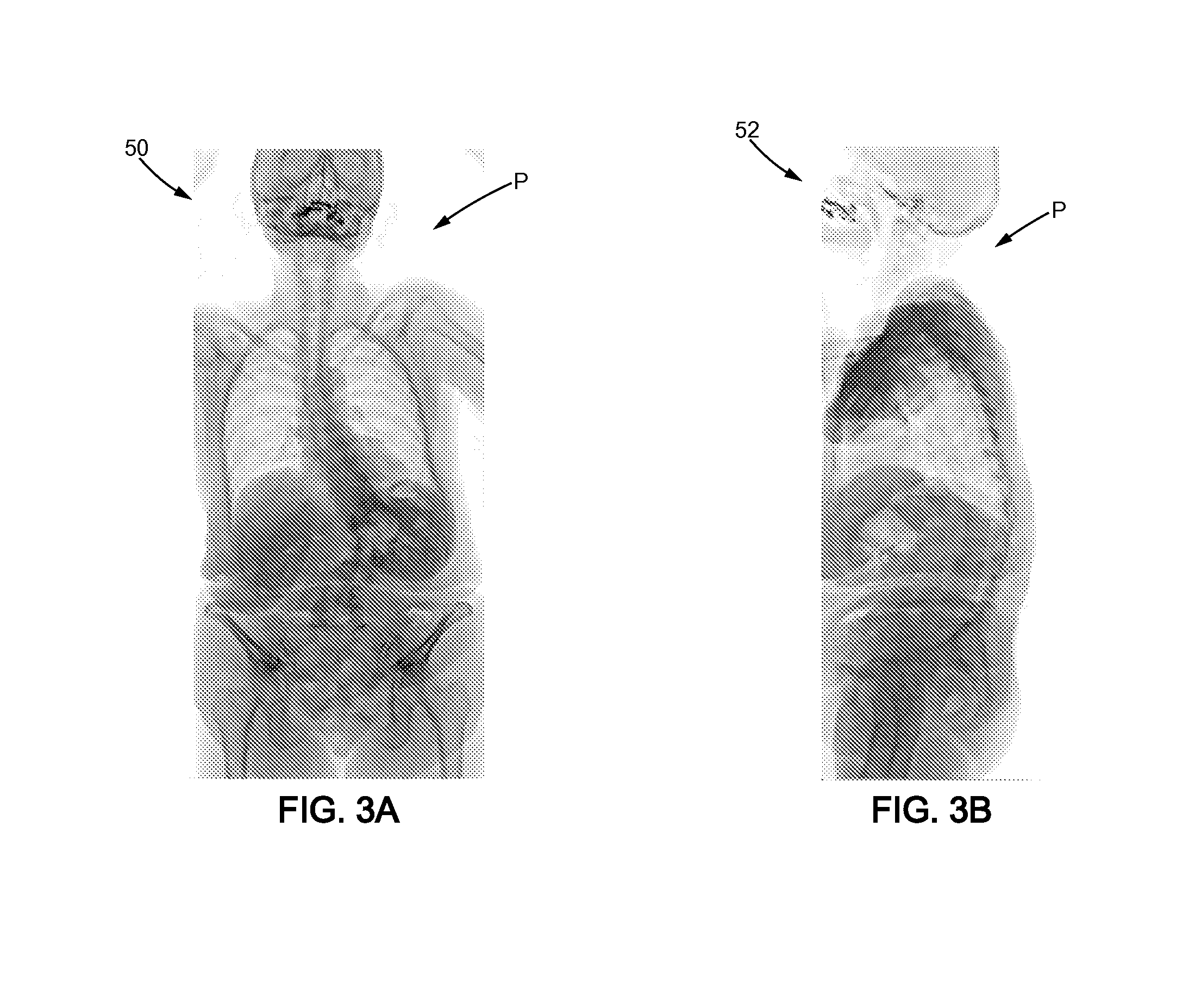 Method for designing a patient specific orthopaedic device