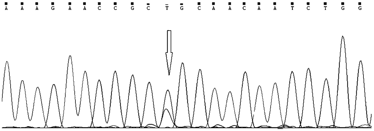 Isolated familial hypertriglyceridemia disease lpl novel mutation causative gene and kit for detecting the gene