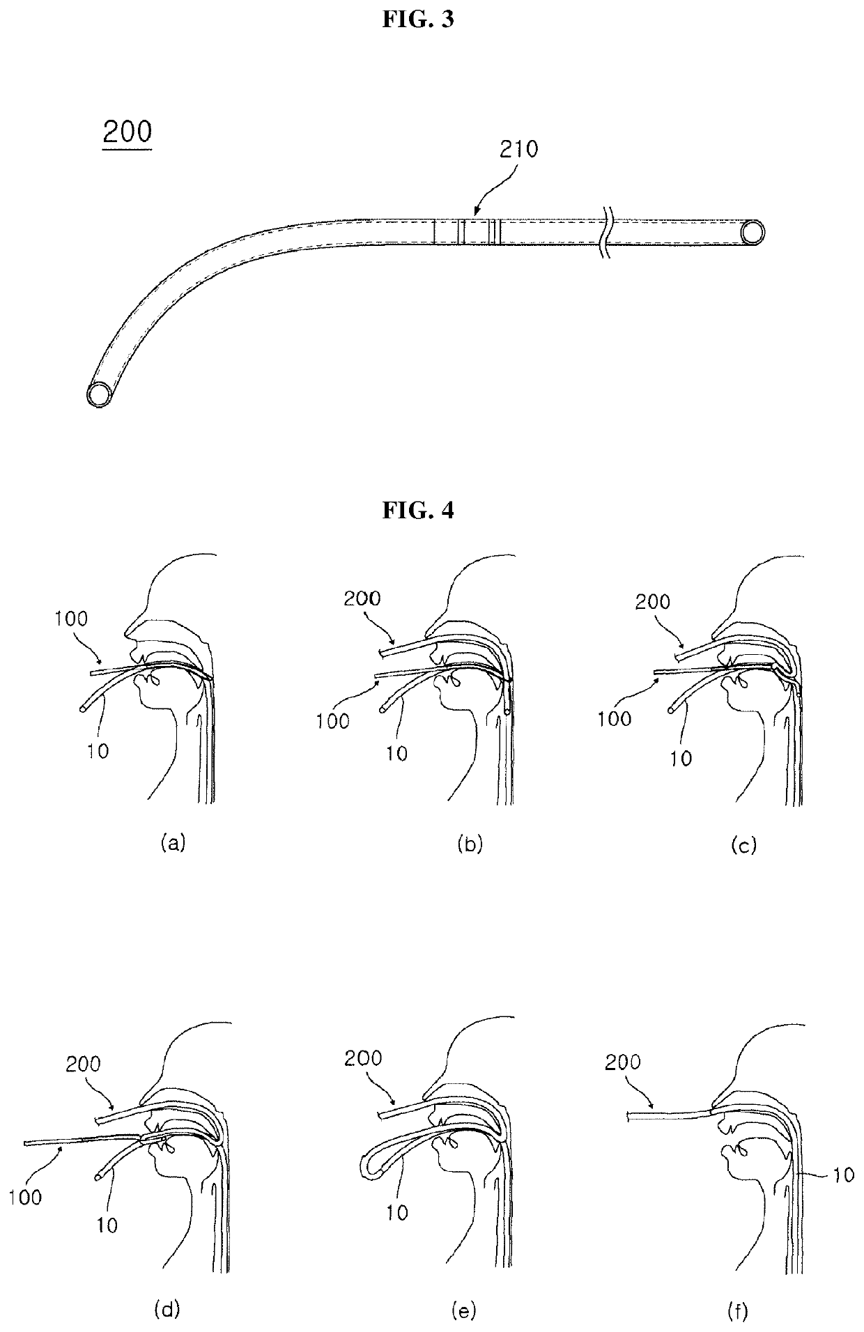 Device for oral-to-nasal repositioning of nasobiliary drainage tube