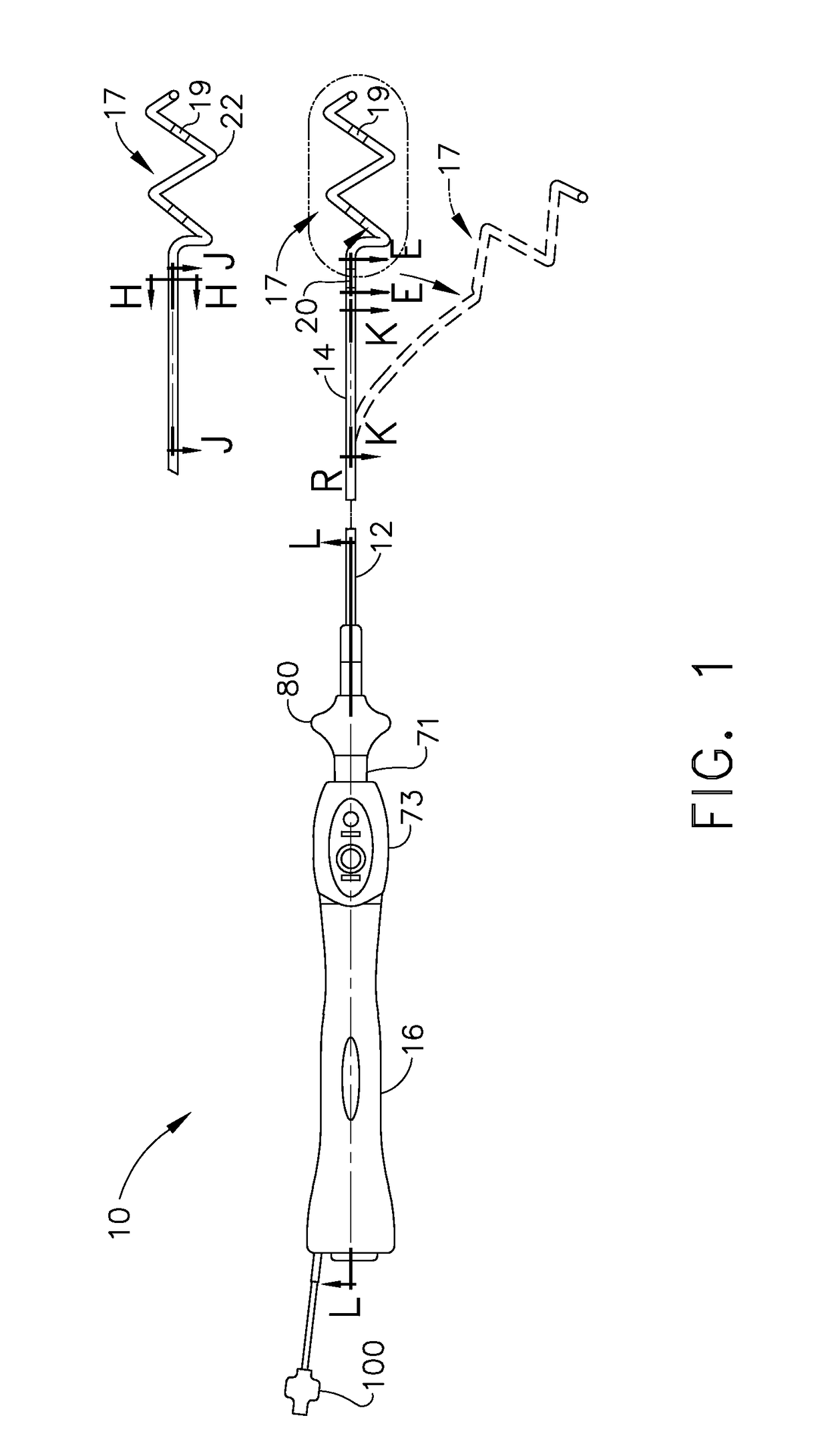 Catheter with helical end section for vessel ablation
