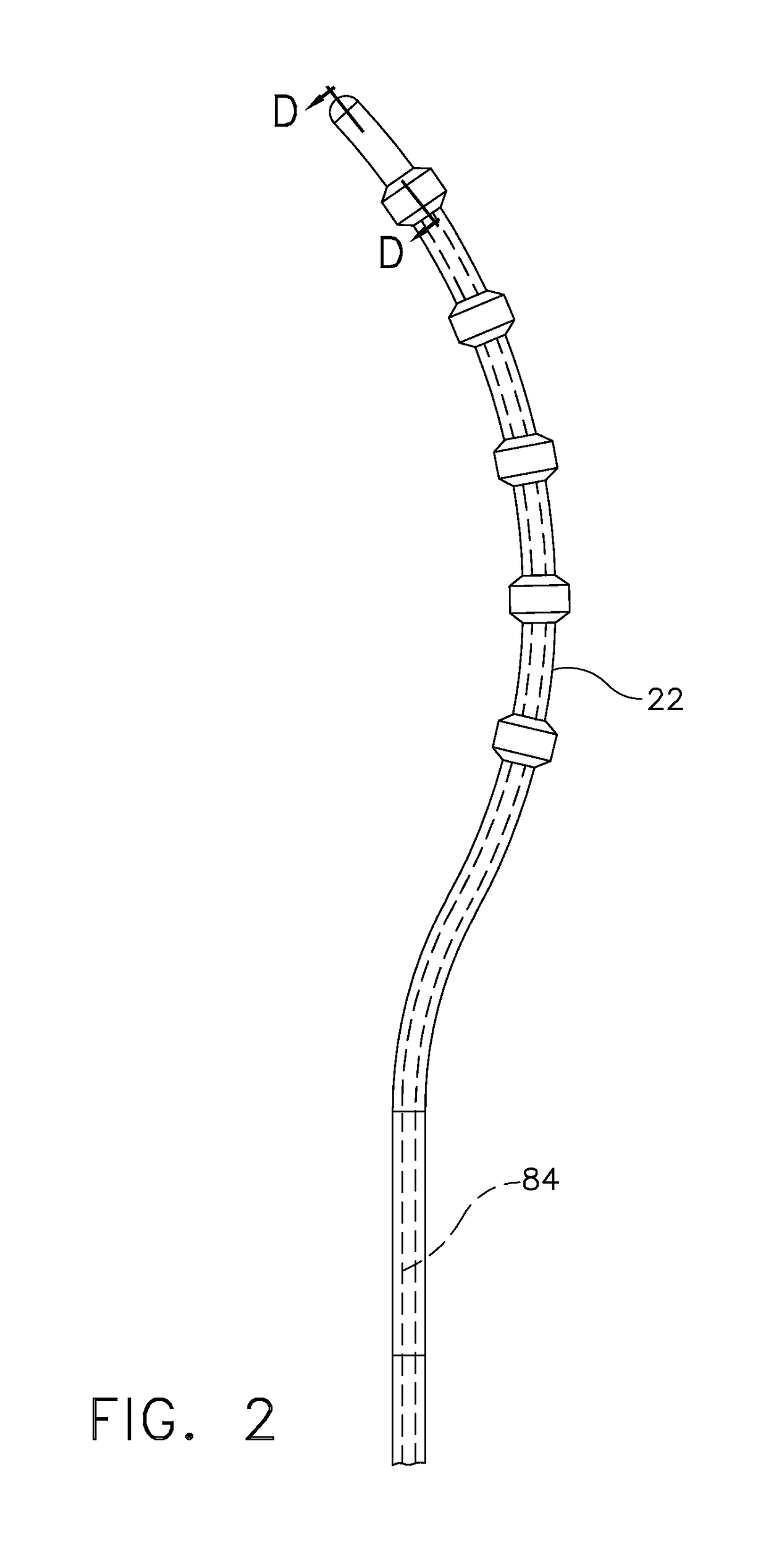 Catheter with helical end section for vessel ablation