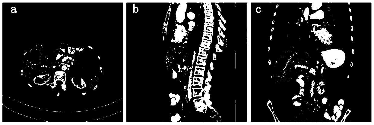 A liver image segmentation method based on a dense feature pyramid network