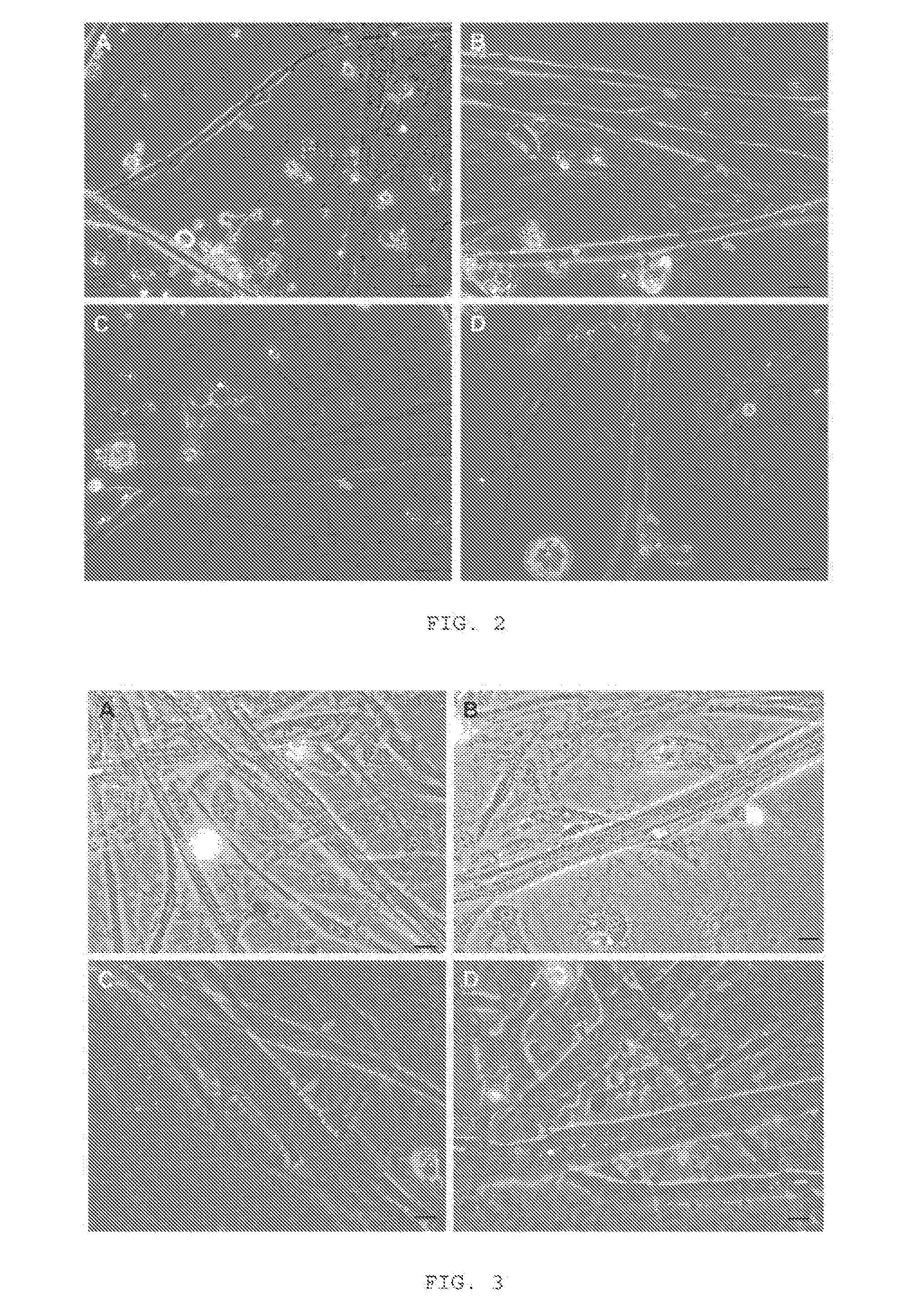 Method of Co-Culturing Mammalian Muscle Cells and Motoneurons