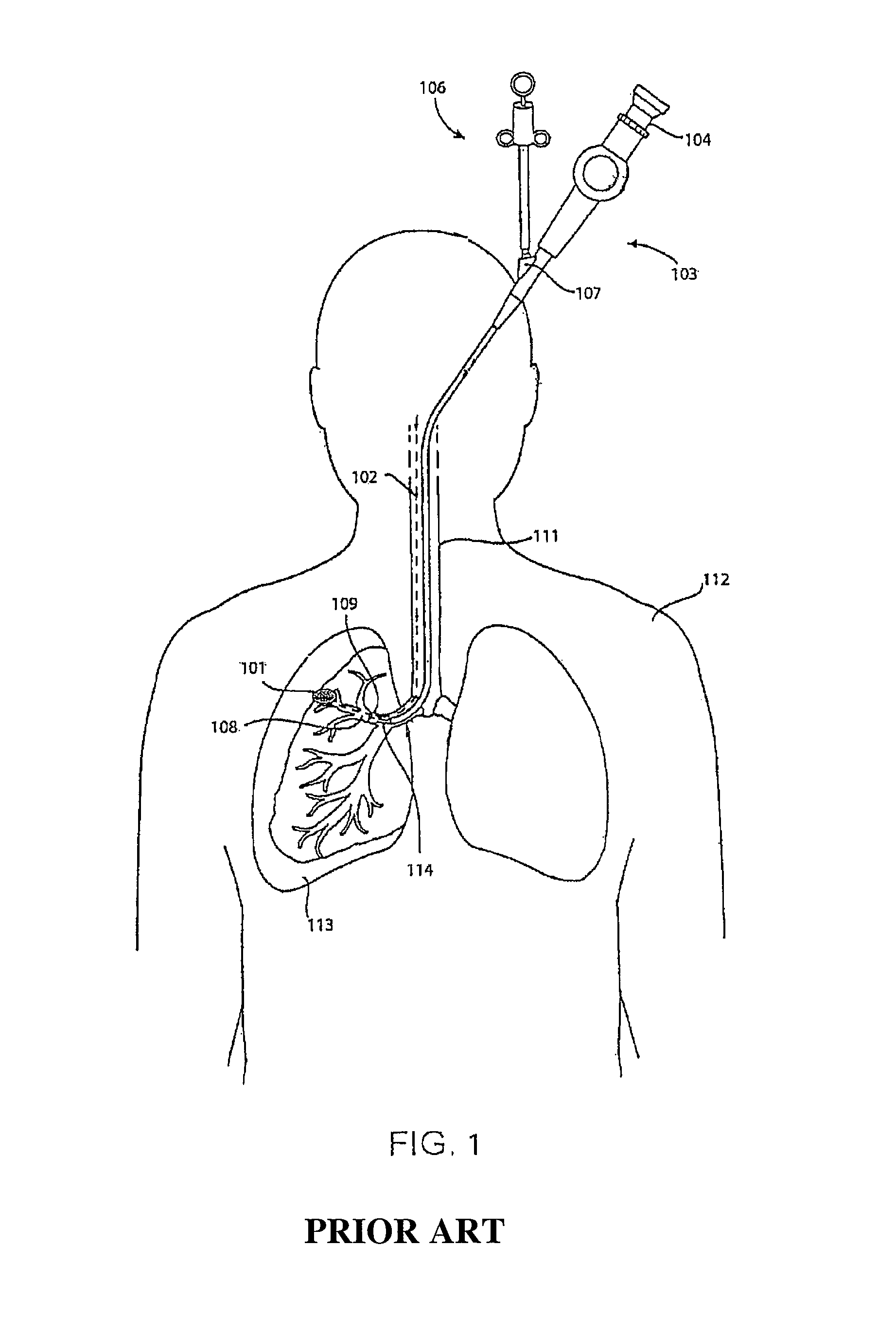 Method and apparatus for guiding an instrument to a target in the lung