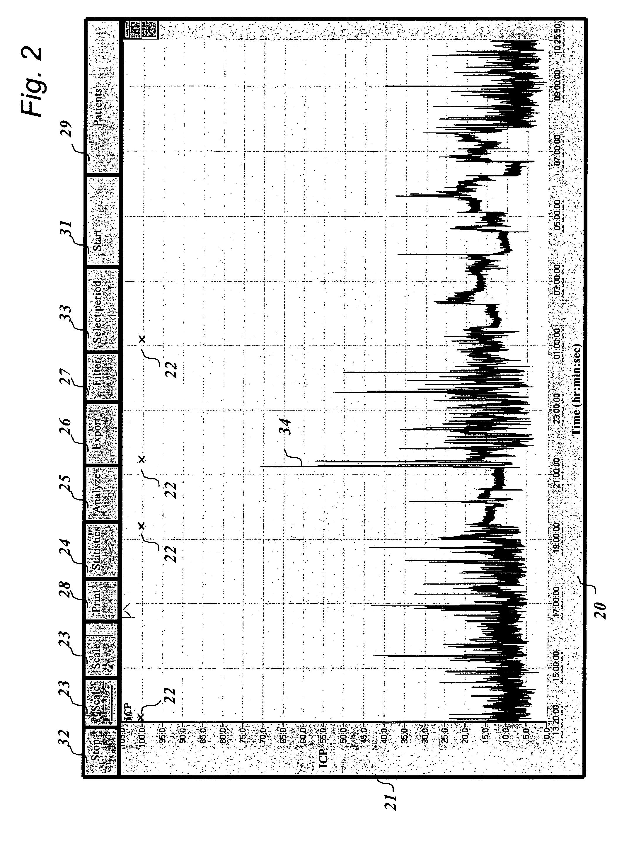 System for performing an analysis of pressure-signals derivable from pressure measurements on or in a body