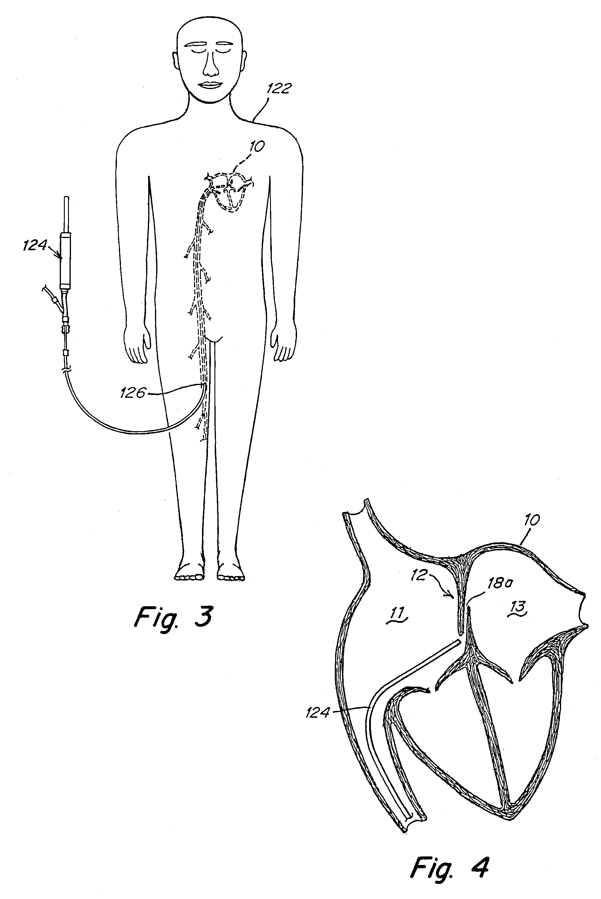 Septal closure device with centering mechanism