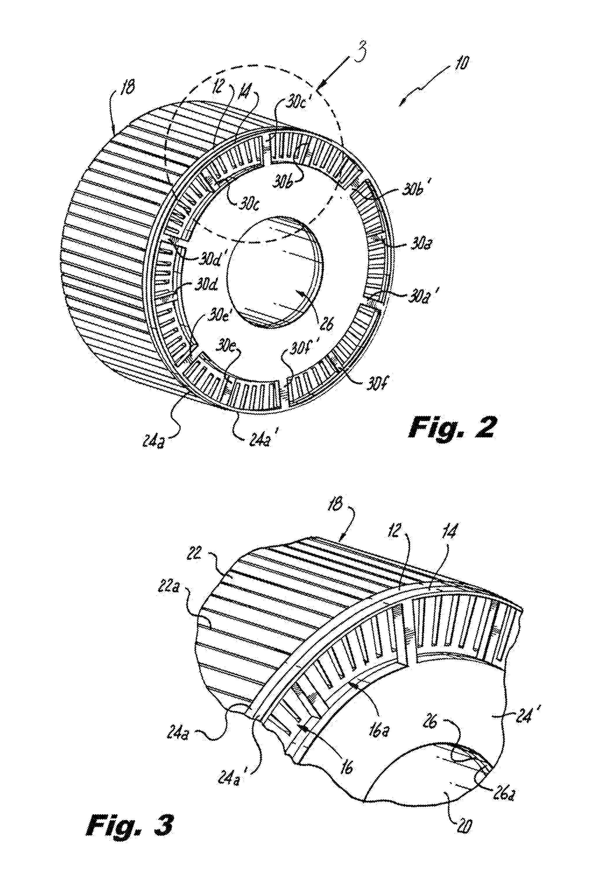 Die Cast Rotor With Steel End Rings to Contain Aluminum
