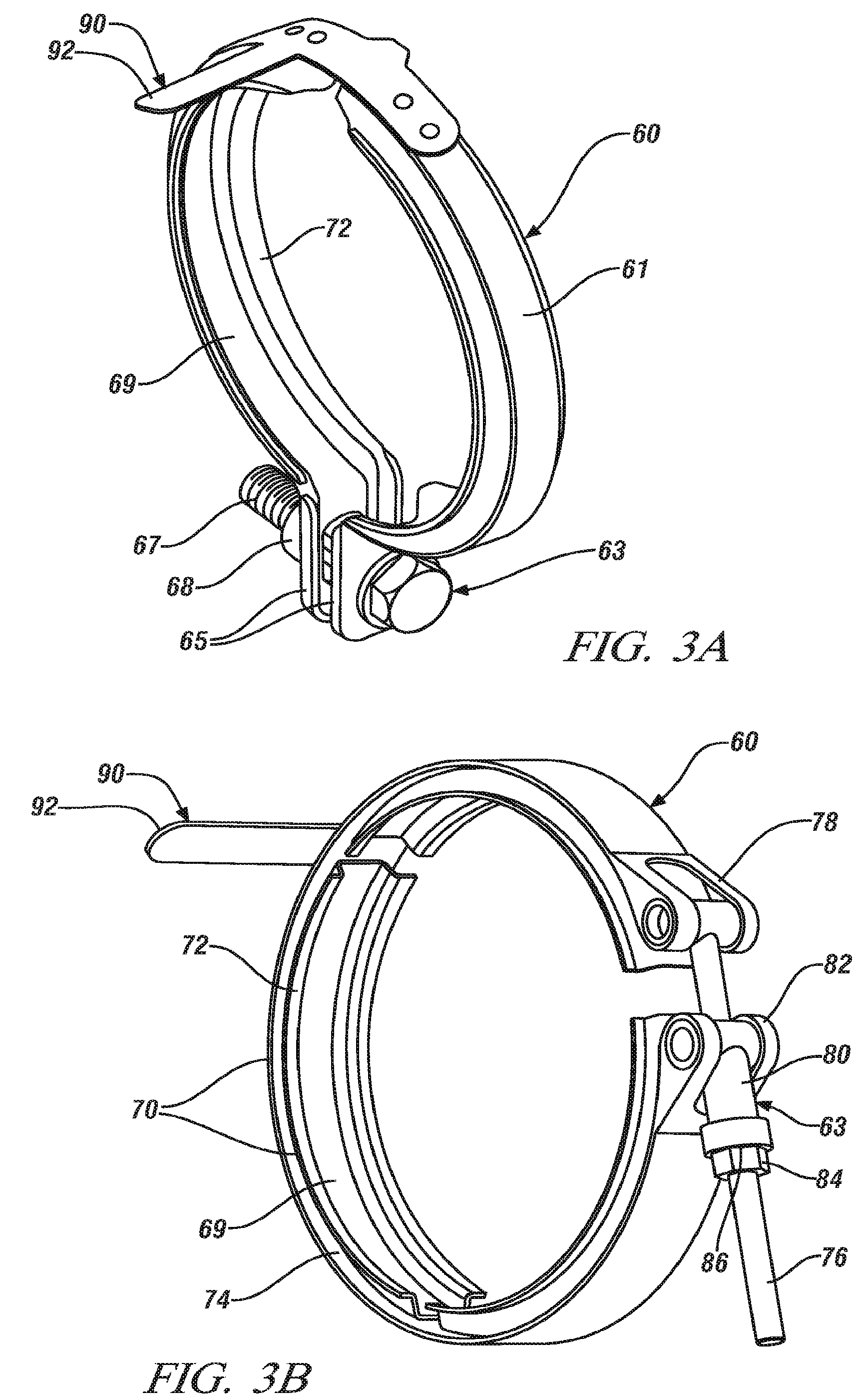 Engine assembly and method of making