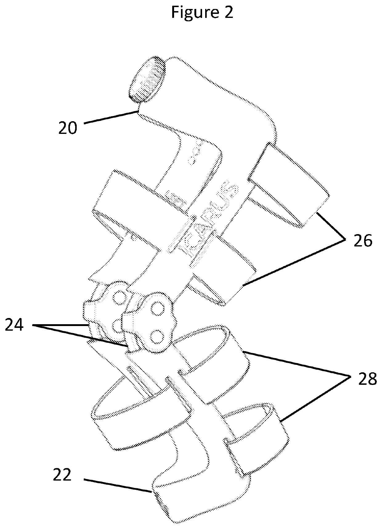 Load distribution device for preventing orthosis migration