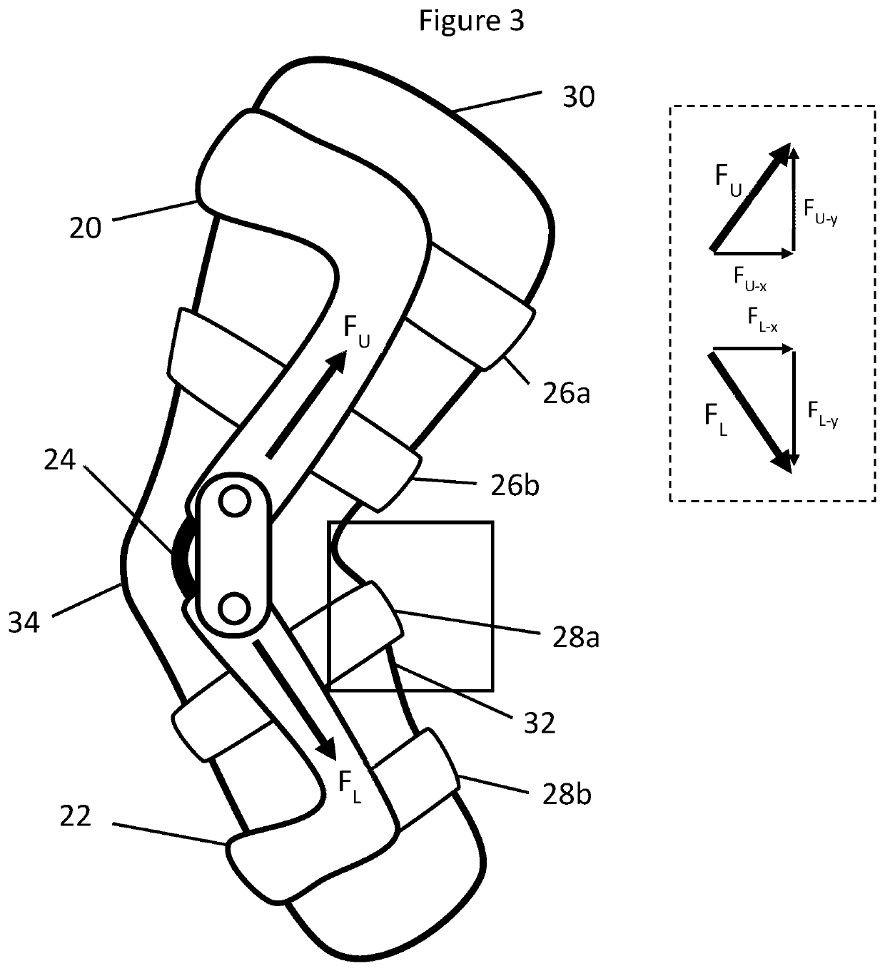 Load distribution device for preventing orthosis migration