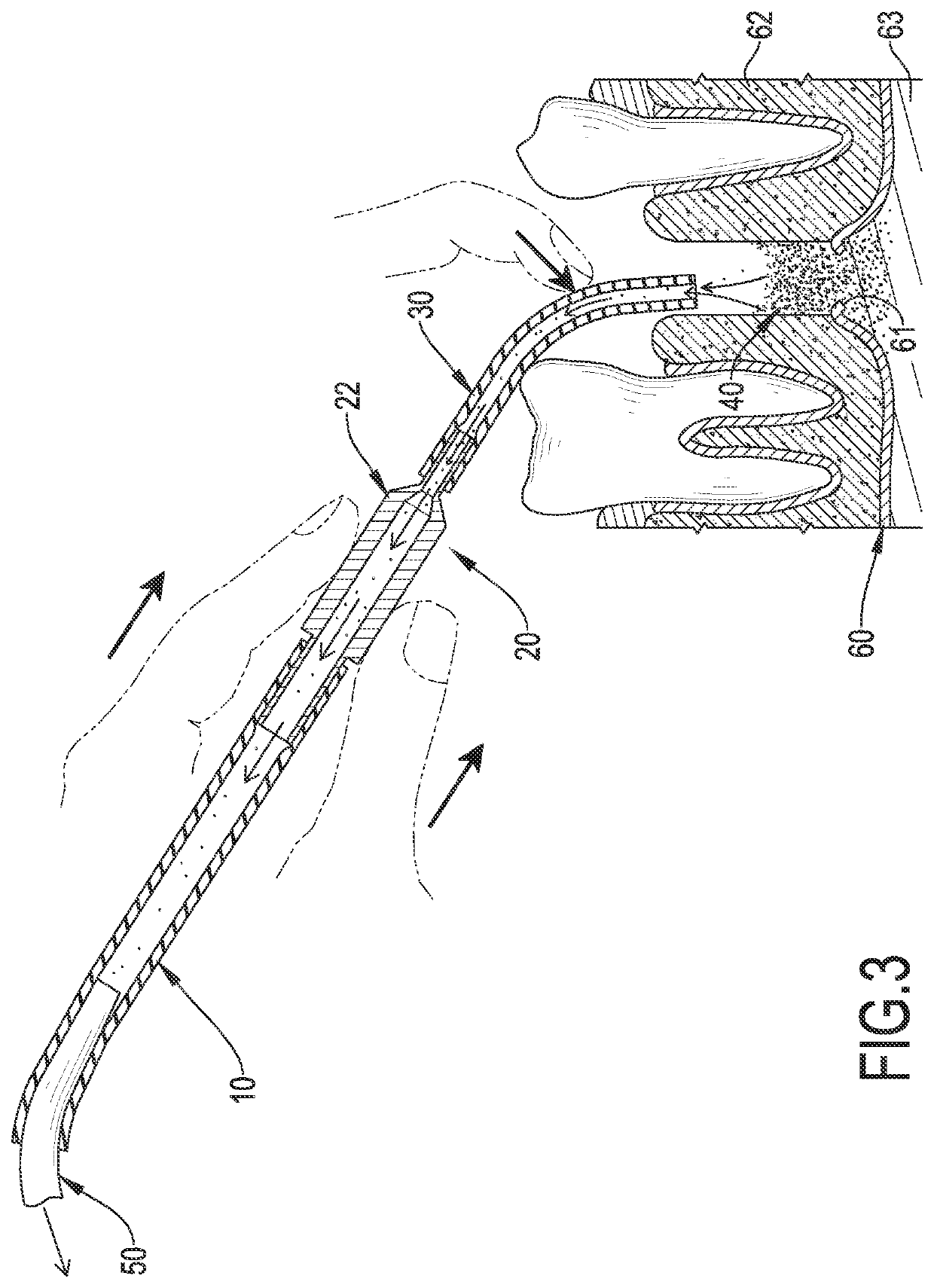 Removing Device for Dentistry