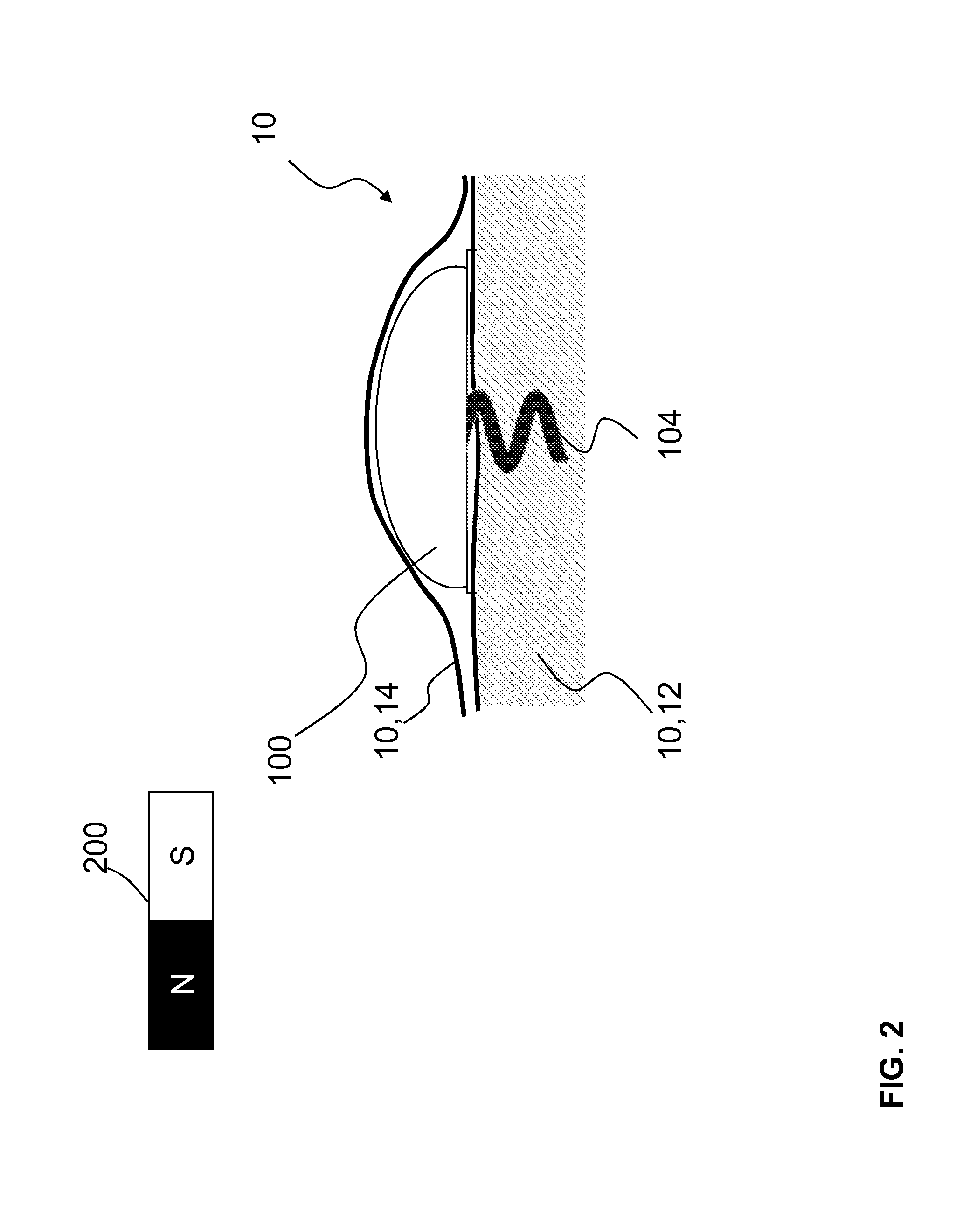 Medical implant with a communications interface