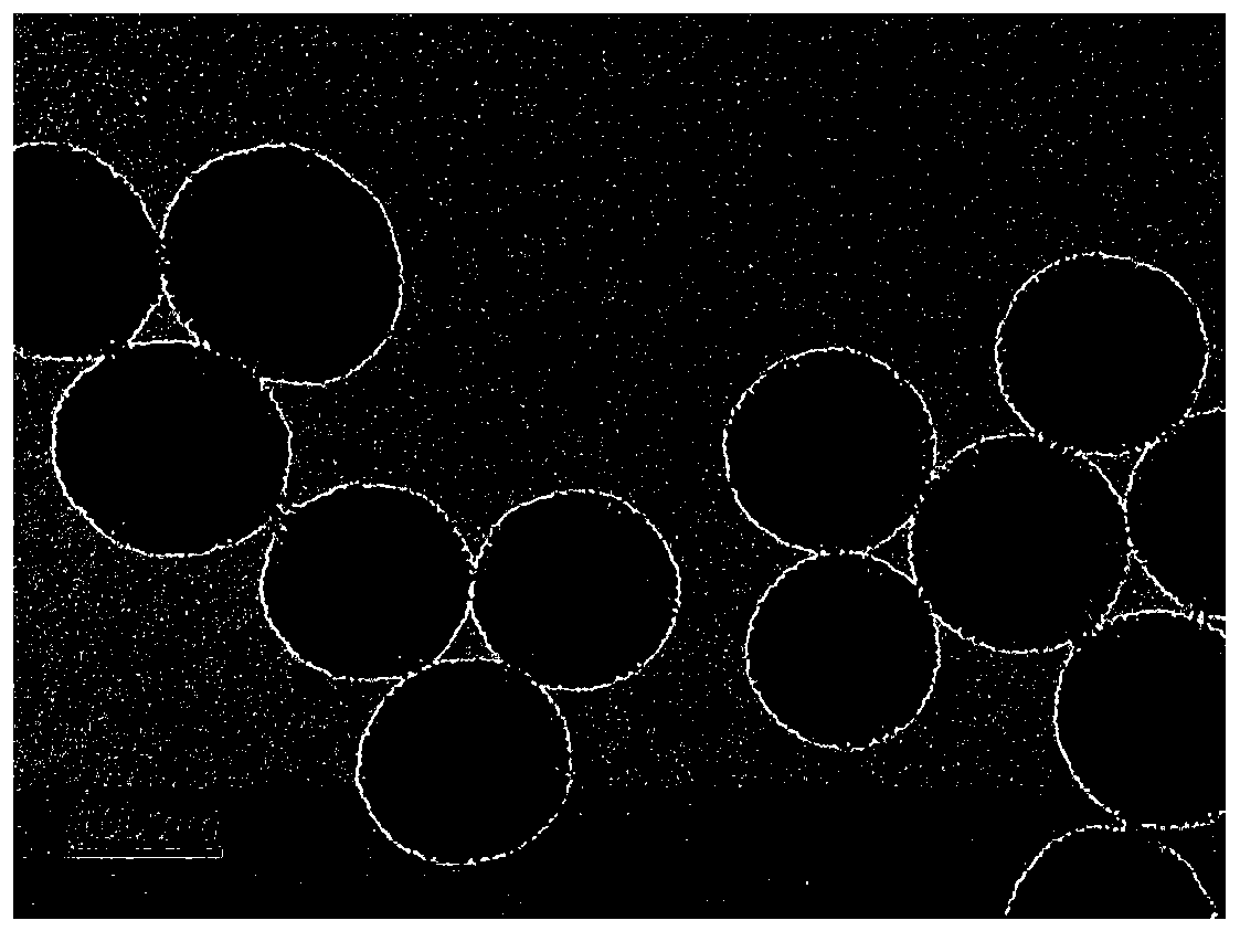 Methotrexate transdermal drug delivery local controlled release preparation and preparation method and application thereof