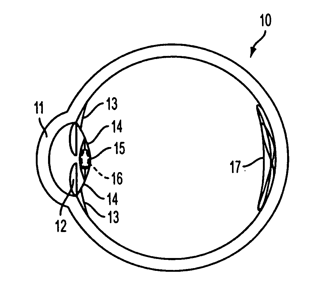 Methods of adjusting the power of an intraocular lens