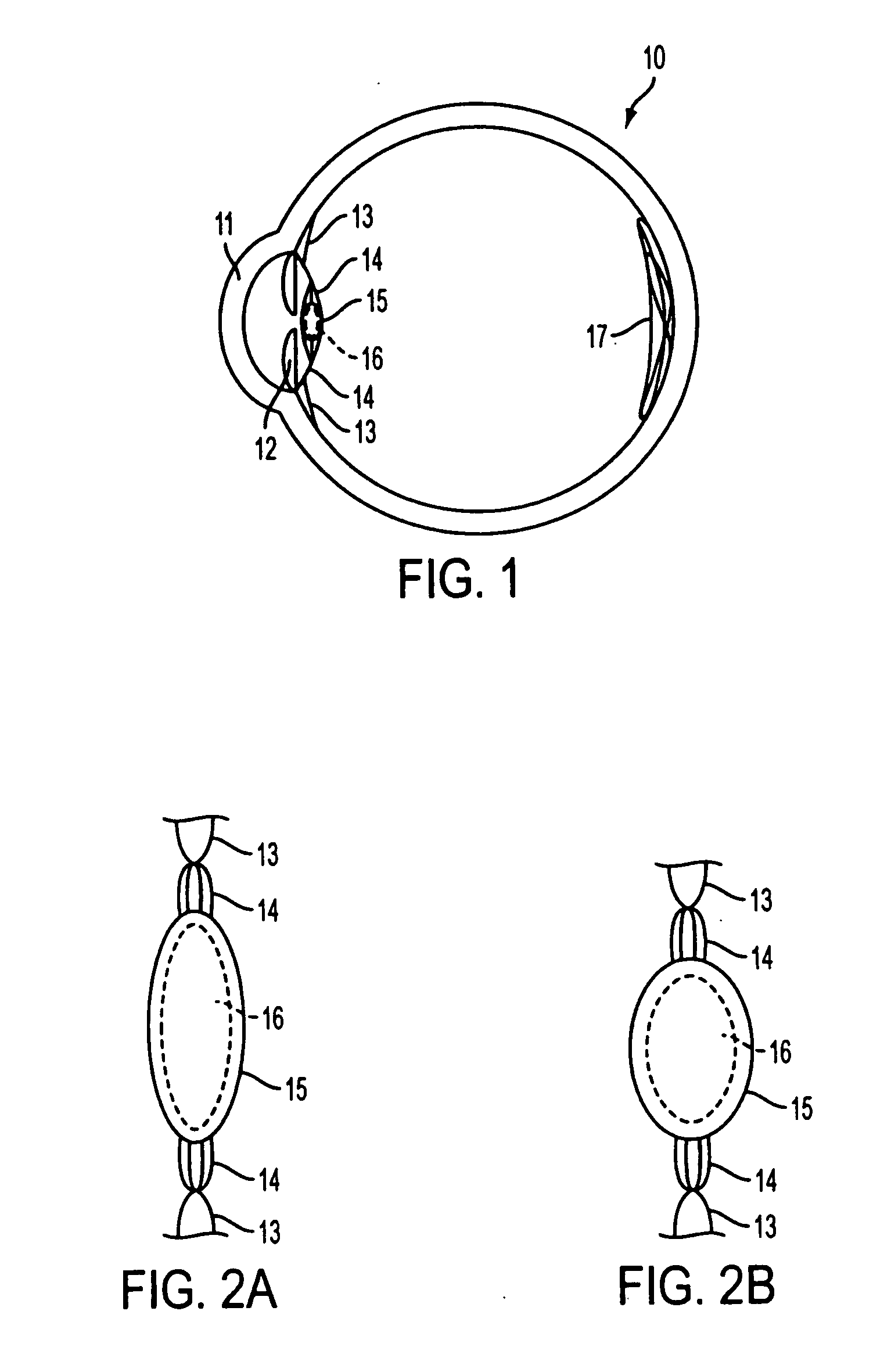 Methods of adjusting the power of an intraocular lens