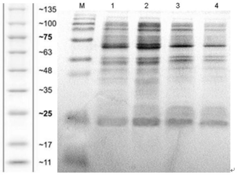 A strain of Bacillus megaterium, its polypeptide agricultural microbial agent, its preparation method and application