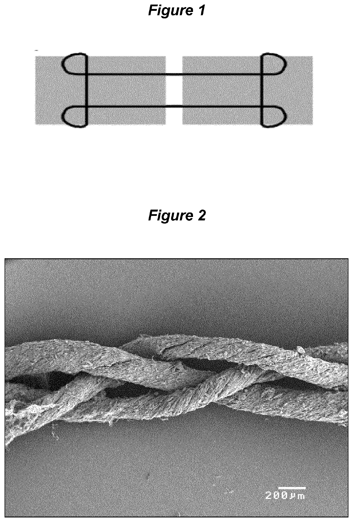 Tissue repair scaffold and device