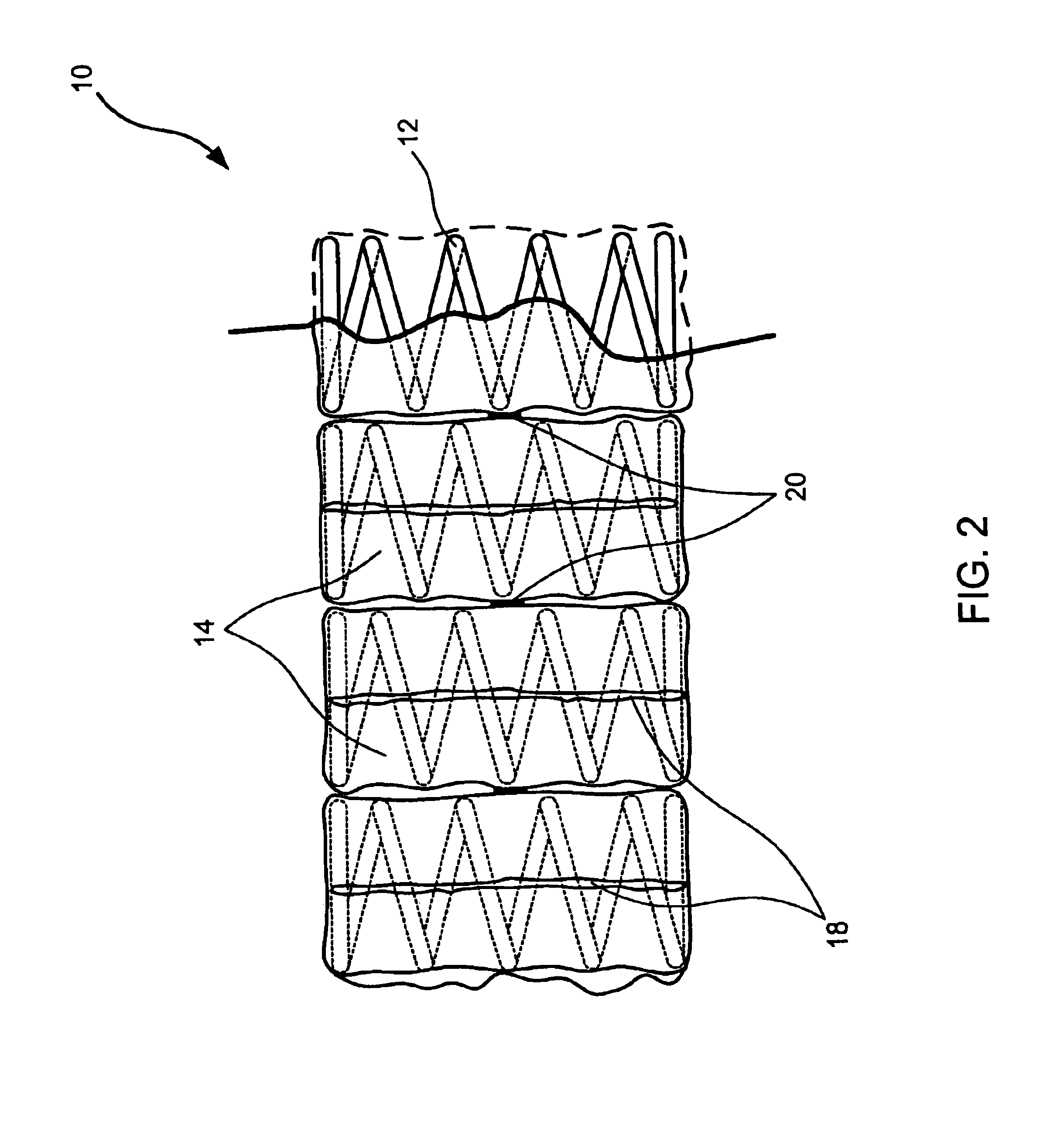 No-flip mattress systems and methods