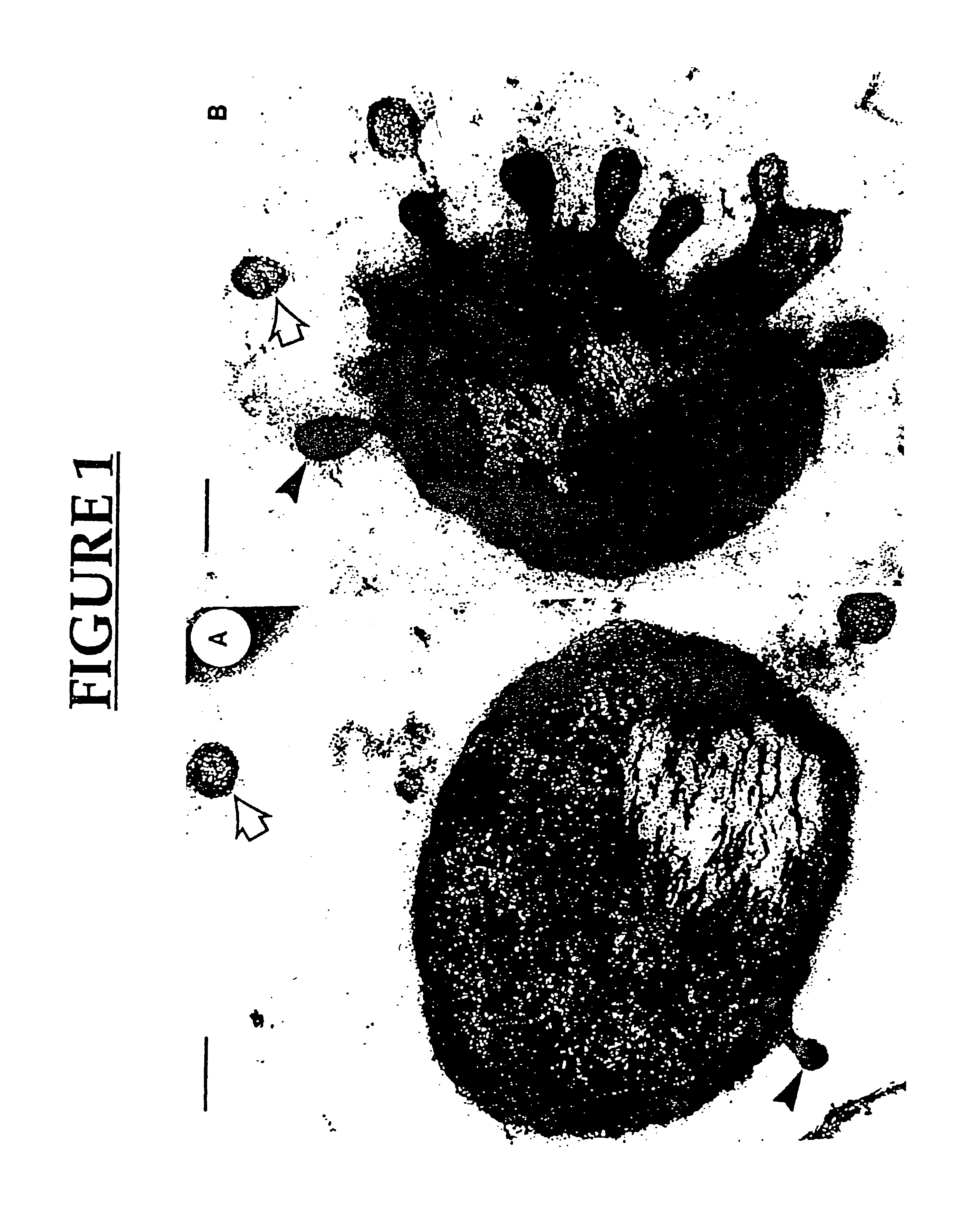 Vaccines and pharmaceutical compositions using membrane vesicles of microorganisms, and methods for preparing same
