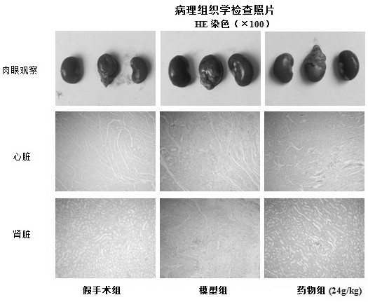 A traditional Chinese medicine composition for preventing and treating cardiorenal syndrome