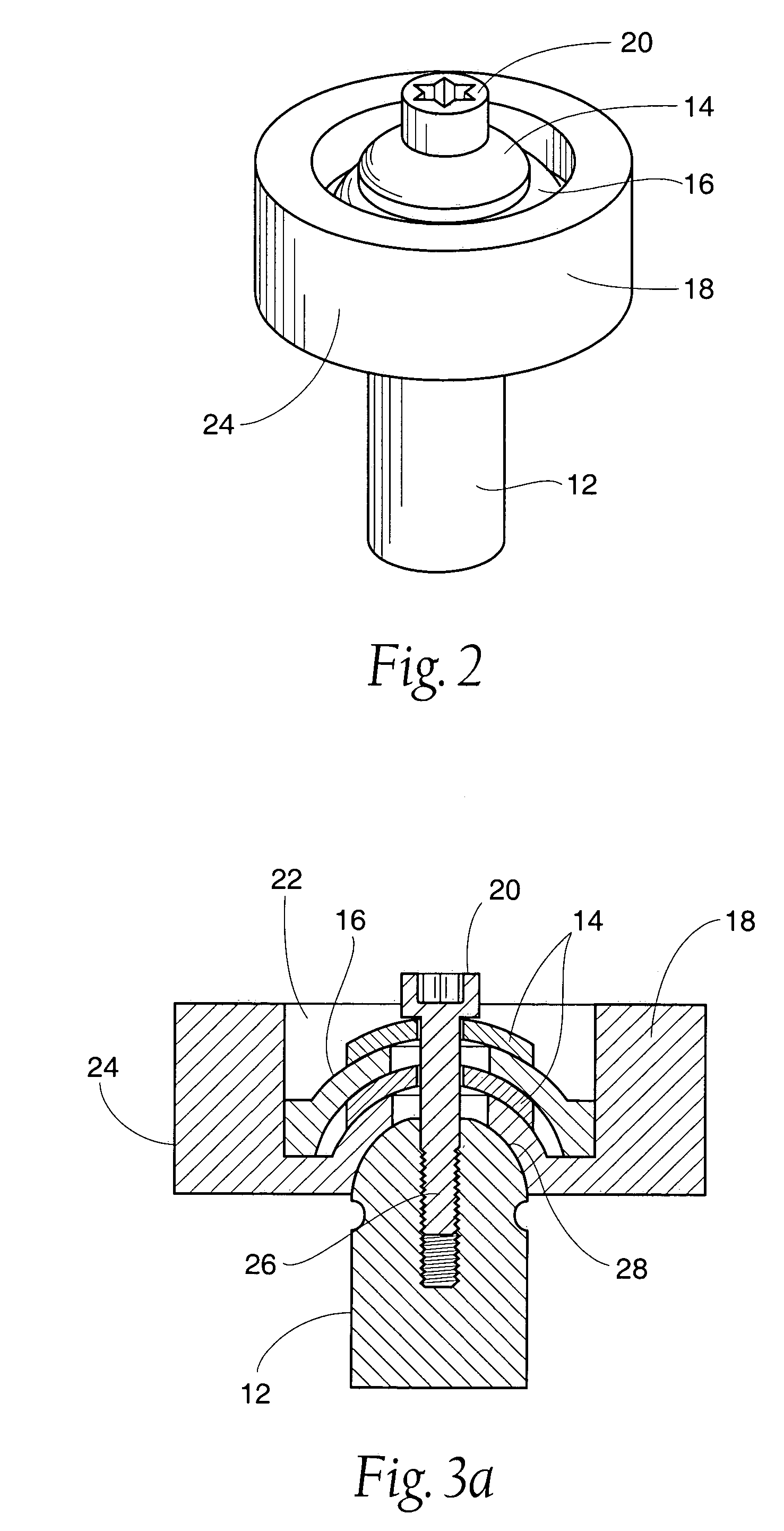 Adjustable bone prostheses and related methods
