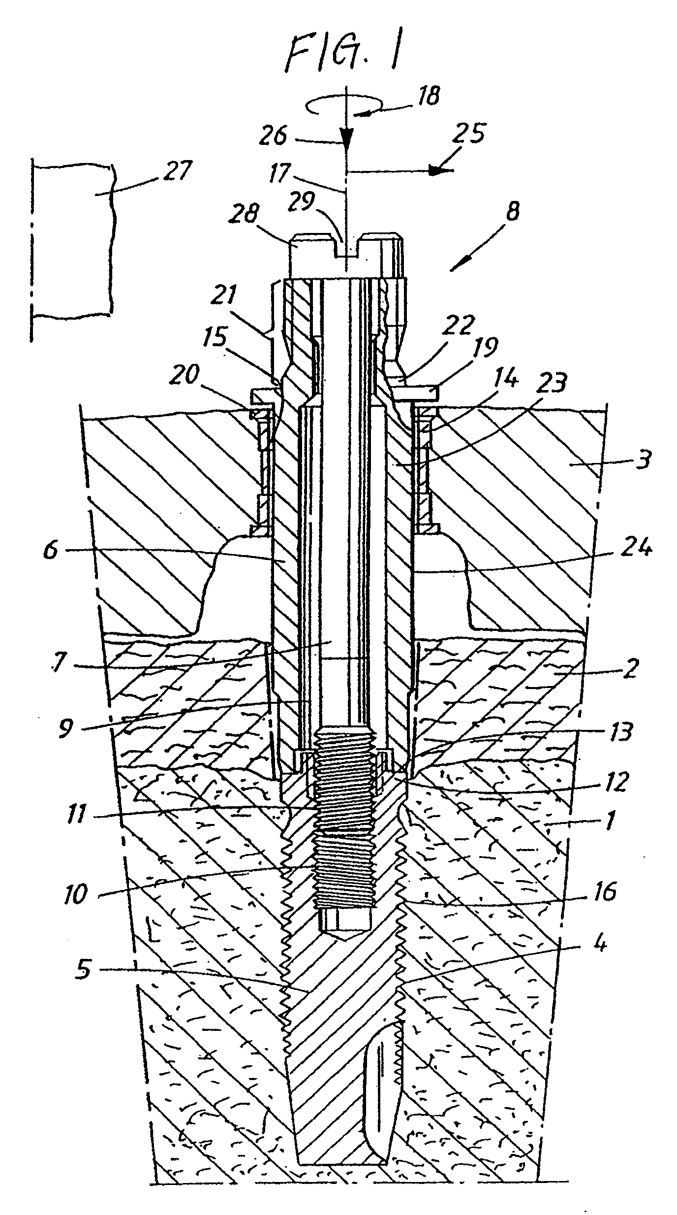 Device and arrangement for fixture installation