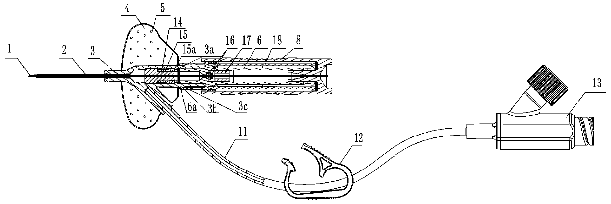 Anti-spill plug for indwelling needle and indwelling needle using anti-spill plug