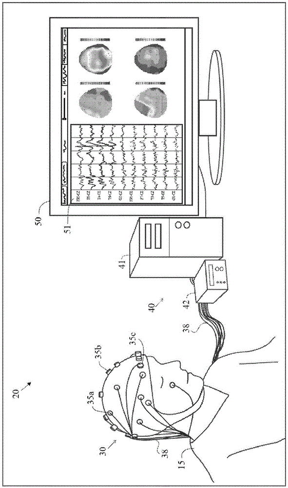 Method and system to calculate quantitative EEG