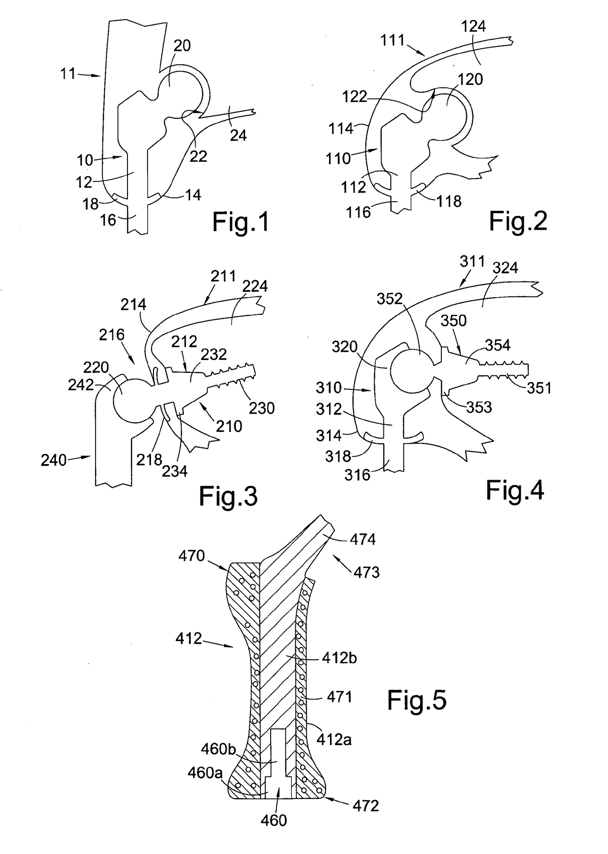 Method of Installing a Percutaneous Device