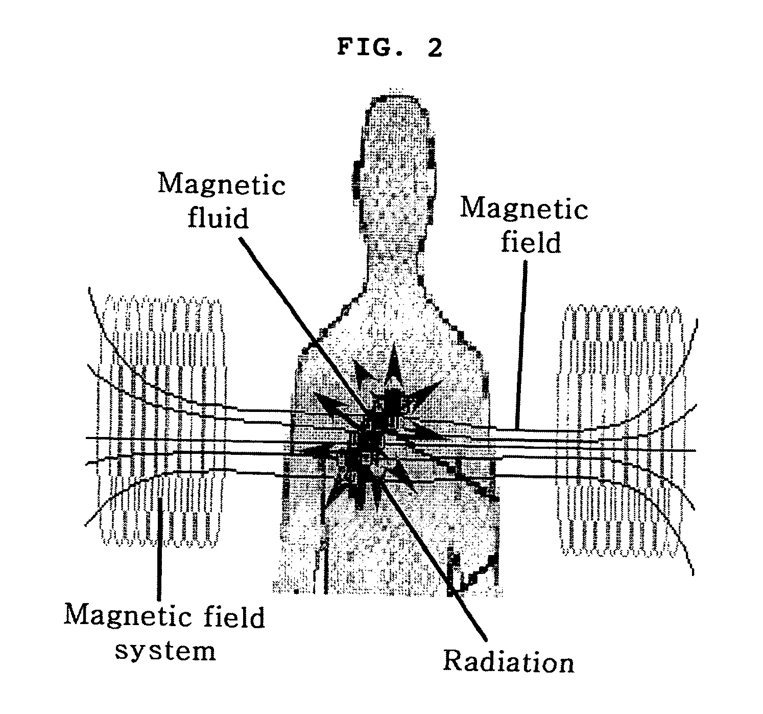 Radioactive magnetic fluids for treatment or diagnosis of cancer, process for preparing them and use thereof